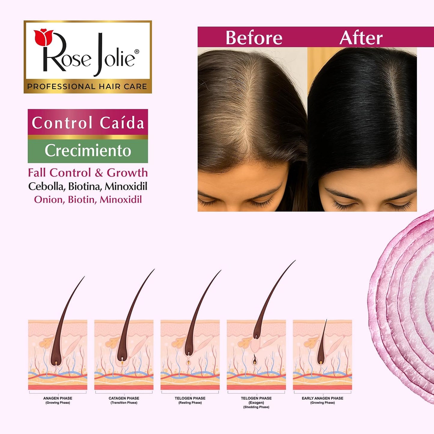 Onion & Biotin Hair Growth Bundle - Shampoo, Hair Mask & Leave-In Conditioner | Sulfate & Paraben Free, 3 Items