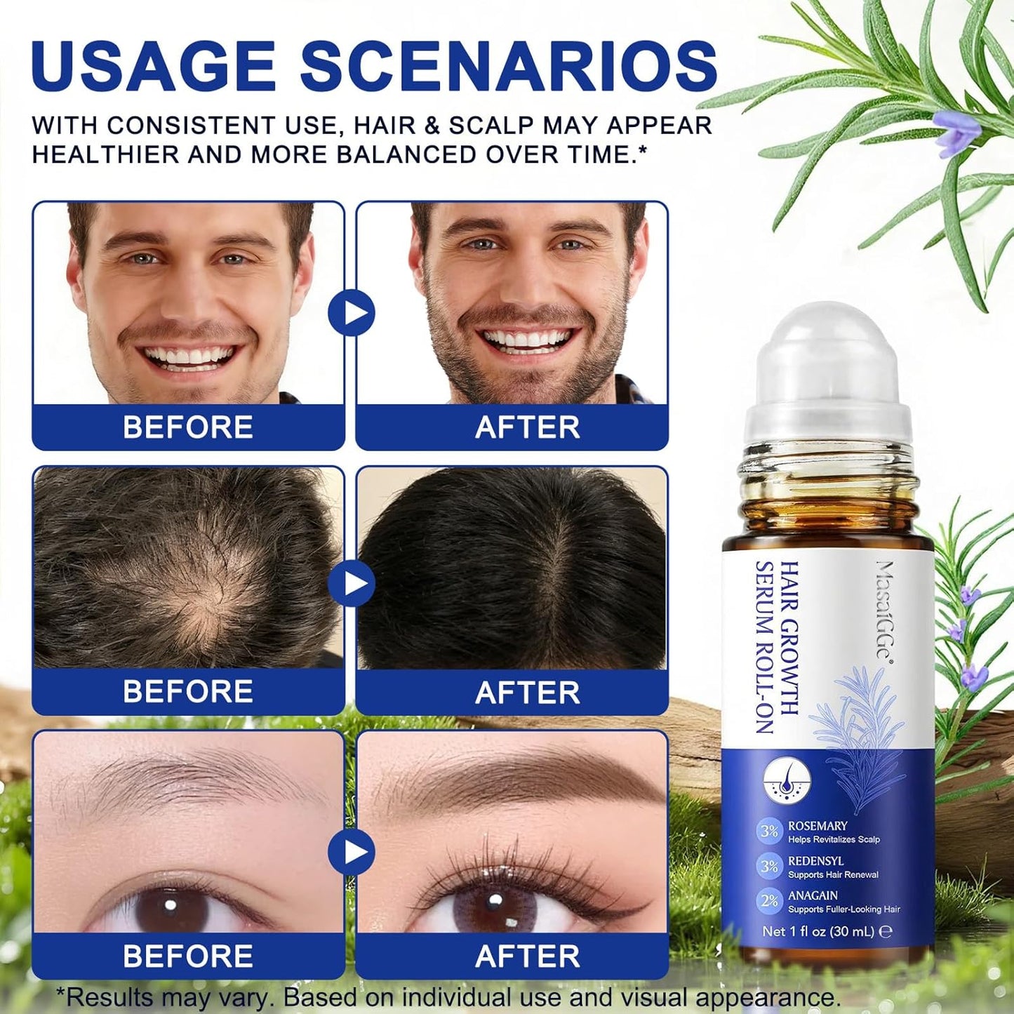 Hair Growth Serum Roll-On | Rosemary Oil for Men & Women - Supports Scalp Health, Fast-Absorbing, Non-Greasy
