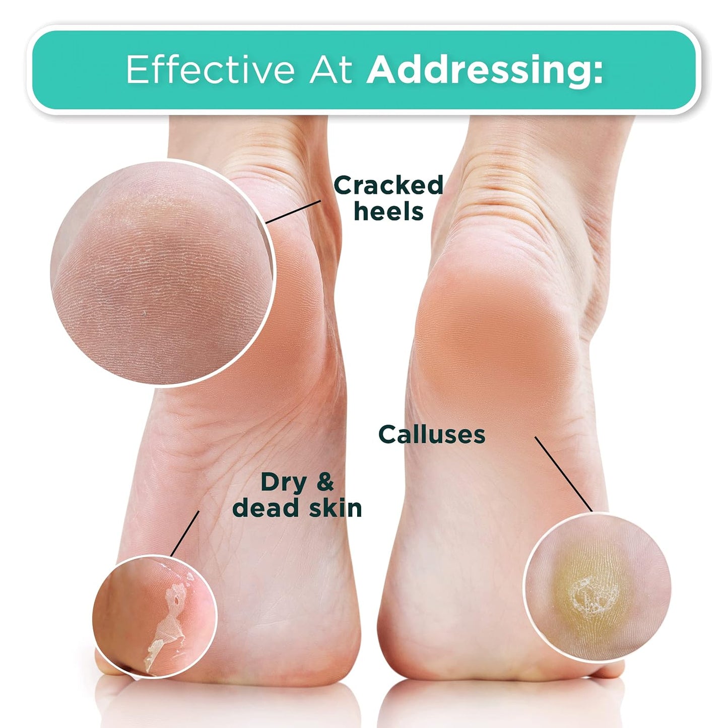 Exfoliating Foot Peel Mask - At-Home Spa Treatment for Dry, Cracked Feet | 2 Pairs Regular Size (Fits Women’s 11, Men’s 10)