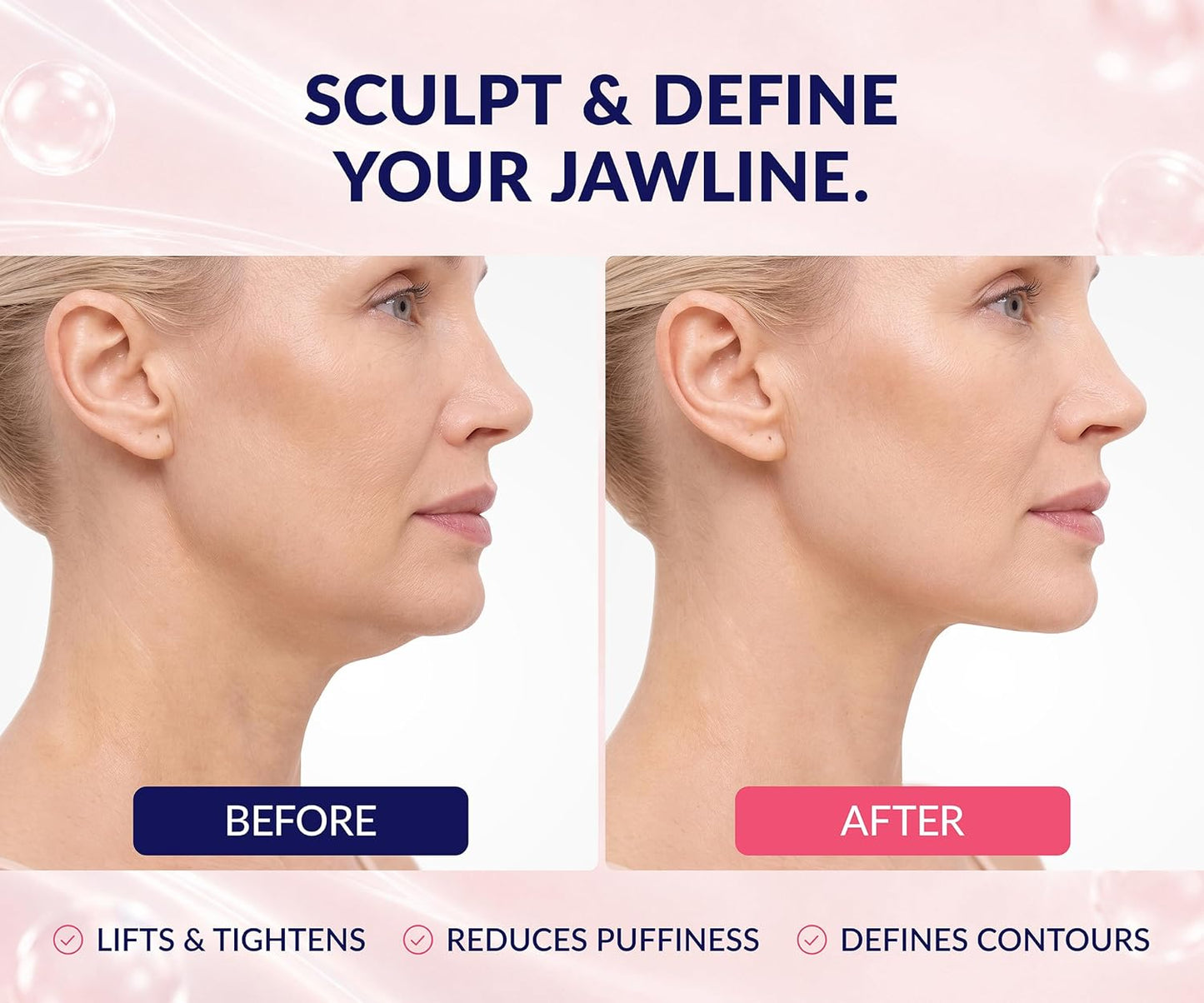 Stylia V Line Lifting Collagen Mask - Firm & Contour Jawline with Hyaluronic Acid & Aloe | 10 Pack