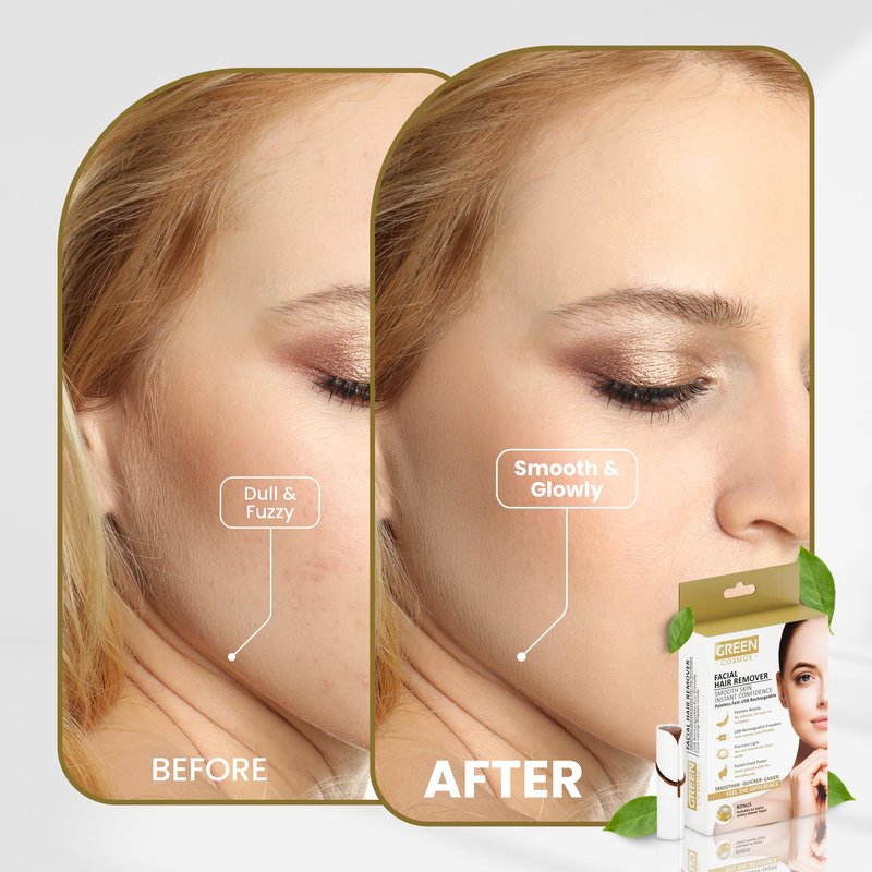 Facial Hair Remover for Women – Gentle & Painless Removal for Peach Fuzz, Lip & Chin – USB Rechargeable