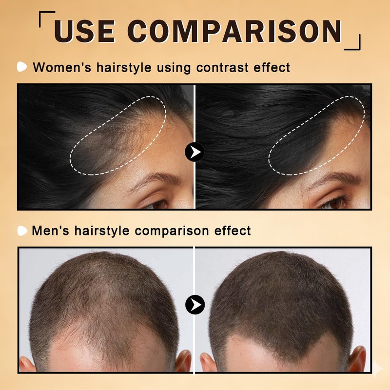 ZHISHUDL Hair Fibers for Thinning Hair for Men & Women Hair Building Fibers Instant Cover Up & Volume Instantly Hair Filler - 02 Dark Brown