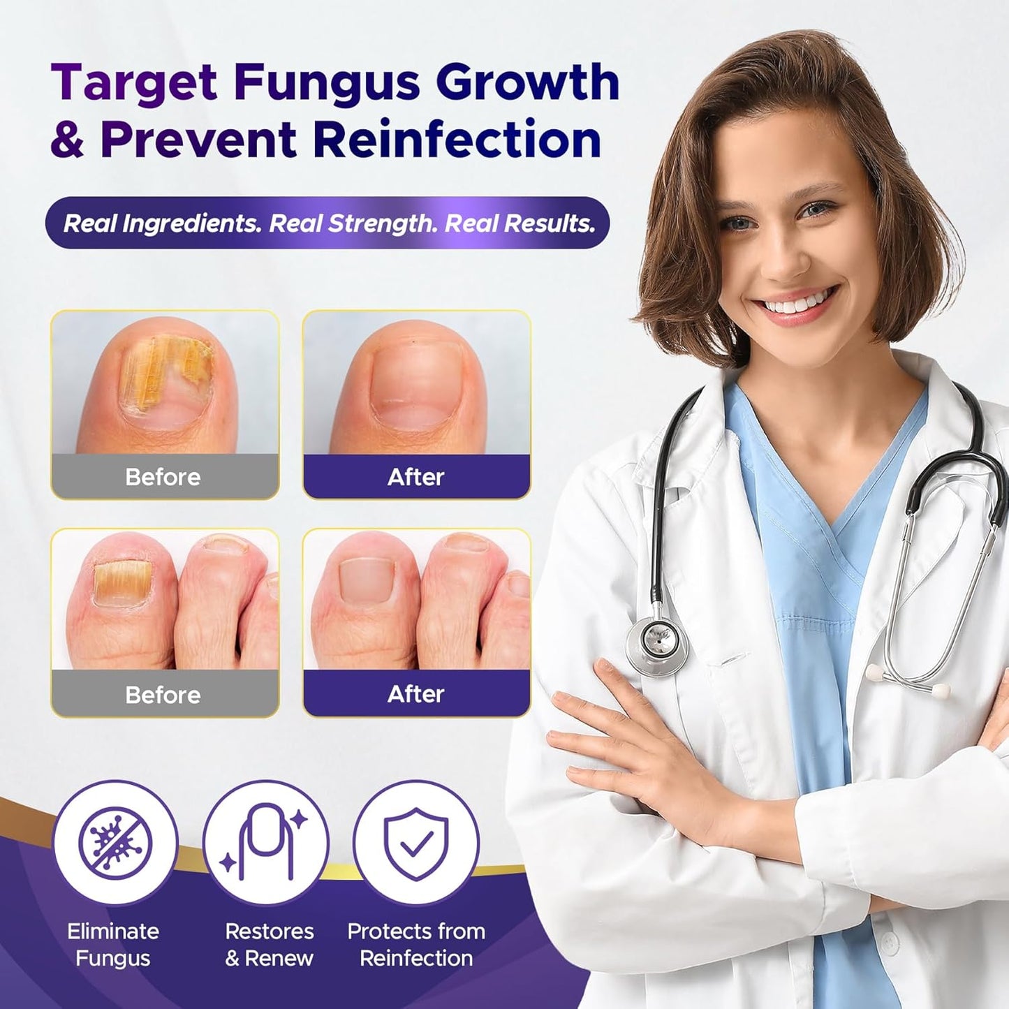 Toenail Fungus Treatment - Extra Strength 25% Undecylenic Acid | Fast-Acting Fungal Nail Revitalizer with Tea Tree Oil (2-Pack)