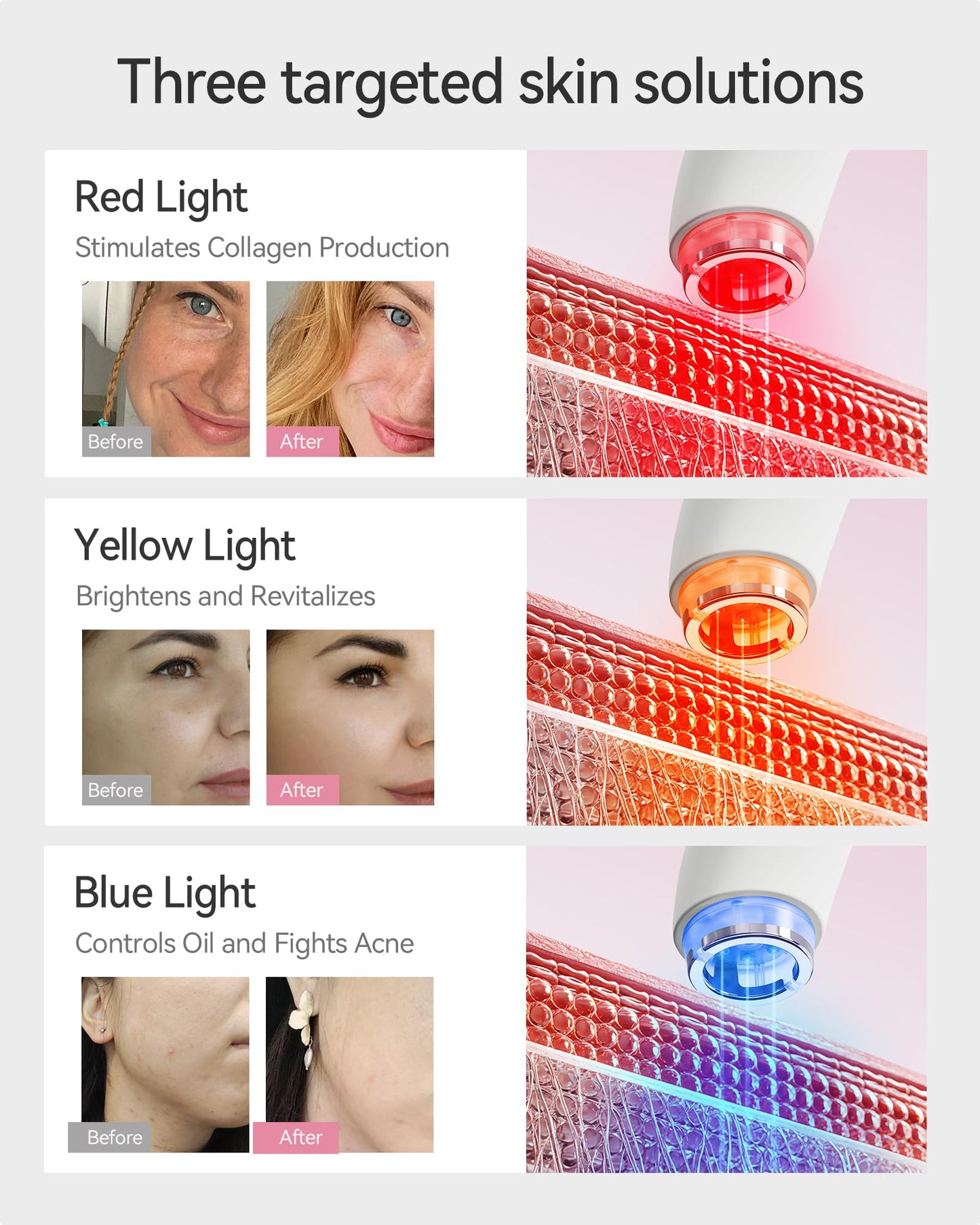 FliKEZE Red Light Therapy Device for Face and Neck, 3-in-1 Microcurrent & Vacuum Facial Massager, Skin Tightening, Firming and Anti-Aging Skincare Tool (White)