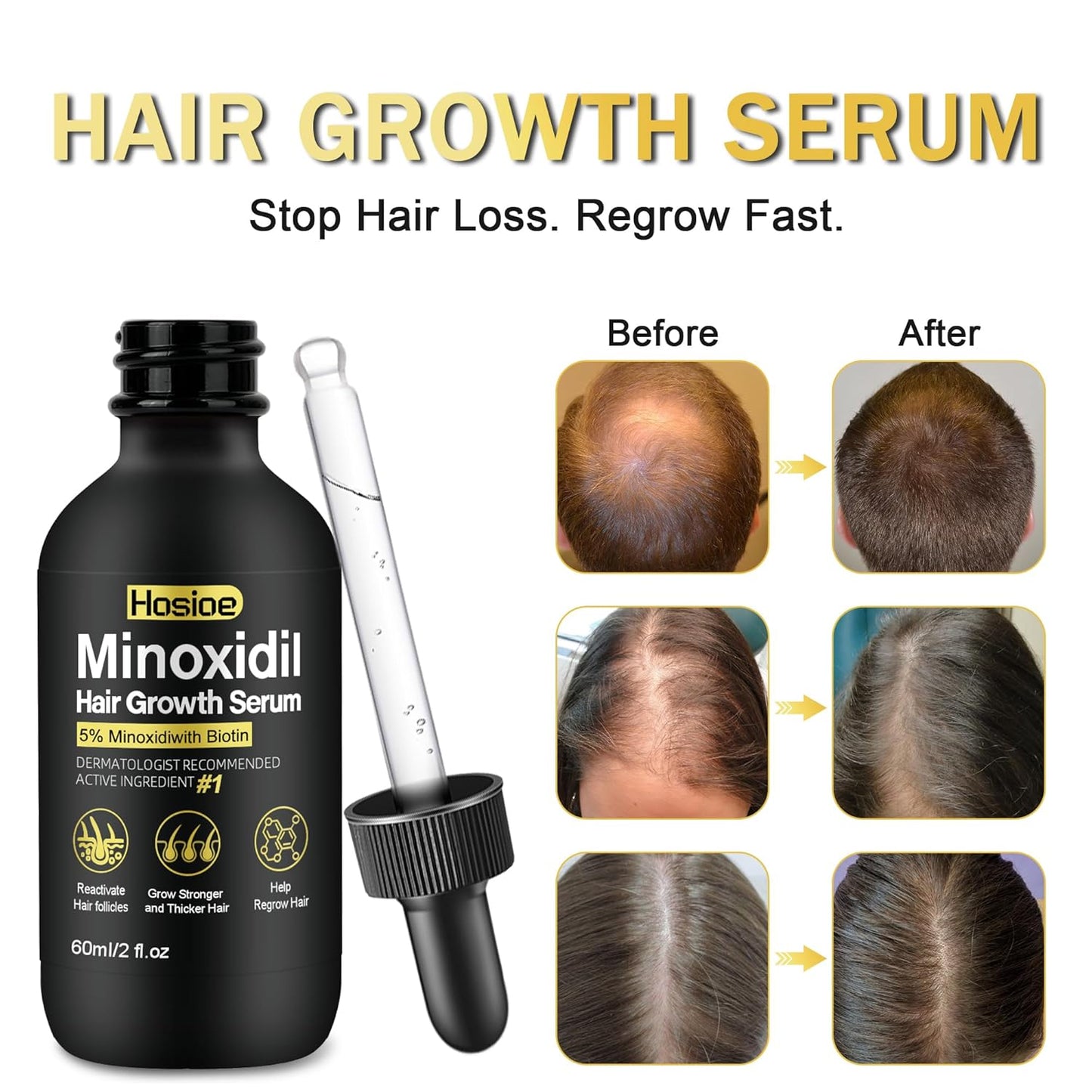 Minoxidil Hair Growth Serum - 5% Topical Treatment for Men & Women | Beard Growth | 3-Pack