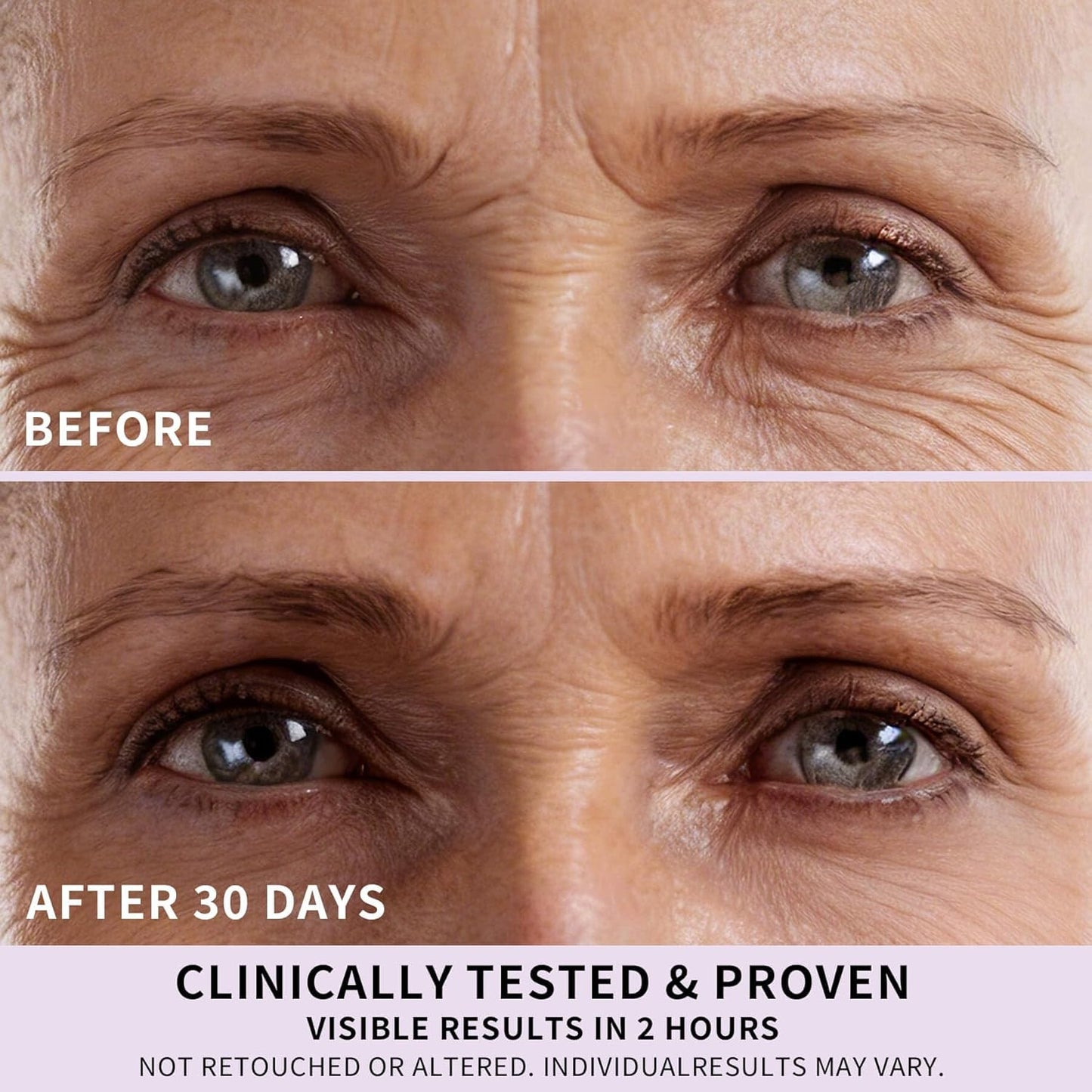 Under Eye Patches - Collagen Peptides & Caffeine | 360° Eye Mask for Dark Circles & Puffiness (12 Pairs)