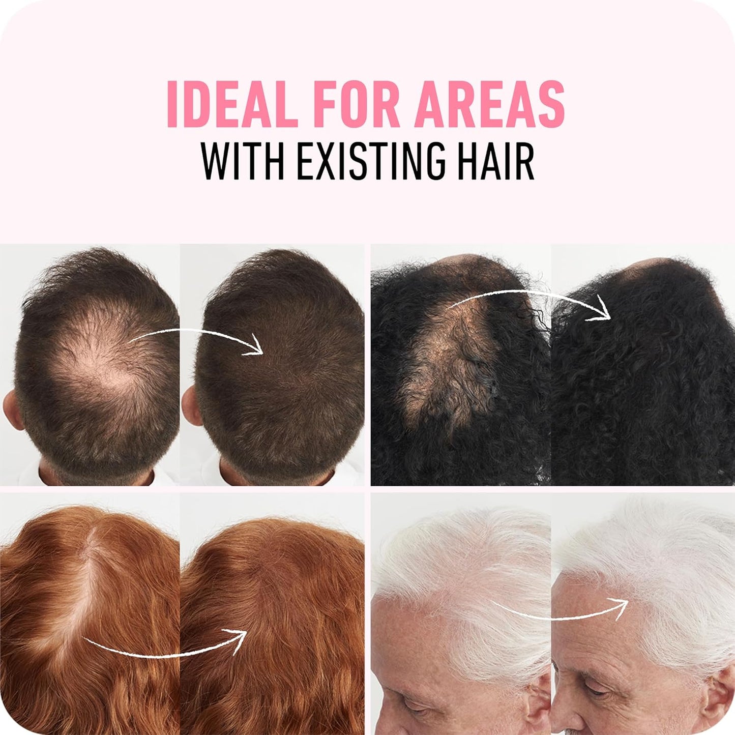 BOLDIFY Hair Fibers - Thinning & Fine Hair Solution for Instant Volume | 56g, Dark Brown, 14 Shades Available