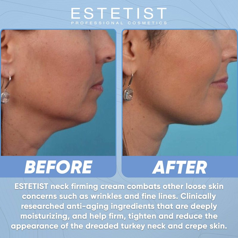 Neck Firming Cream for Tightening & Lifting Sagging Skin - Double Chin Reducer - Anti Wrinkle Anti Aging Treatment for Neck & Décolleté - Crepe Skin Repair for Chest - With Vitamin C & Coconut Oil