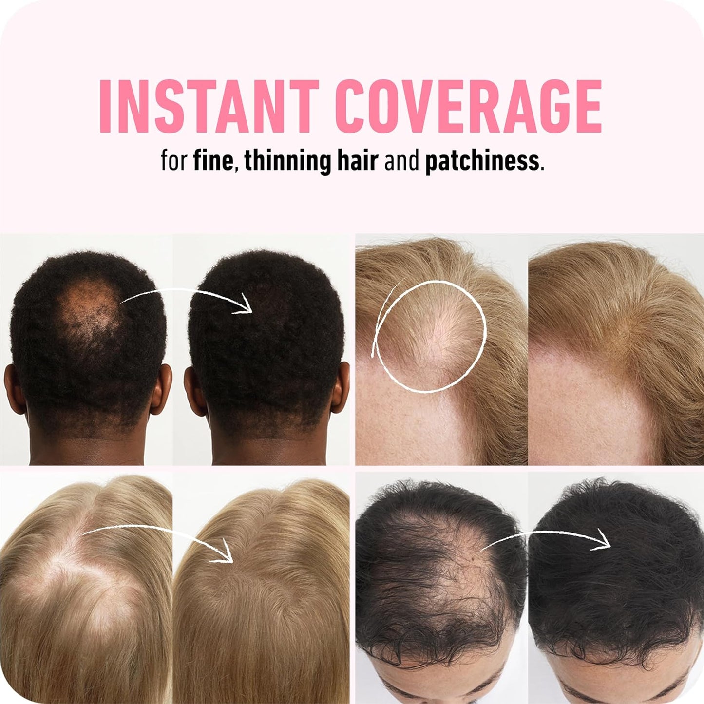 BOLDIFY Hair Fibers - Thinning & Fine Hair Solution for Instant Volume | 56g, Dark Brown, 14 Shades Available
