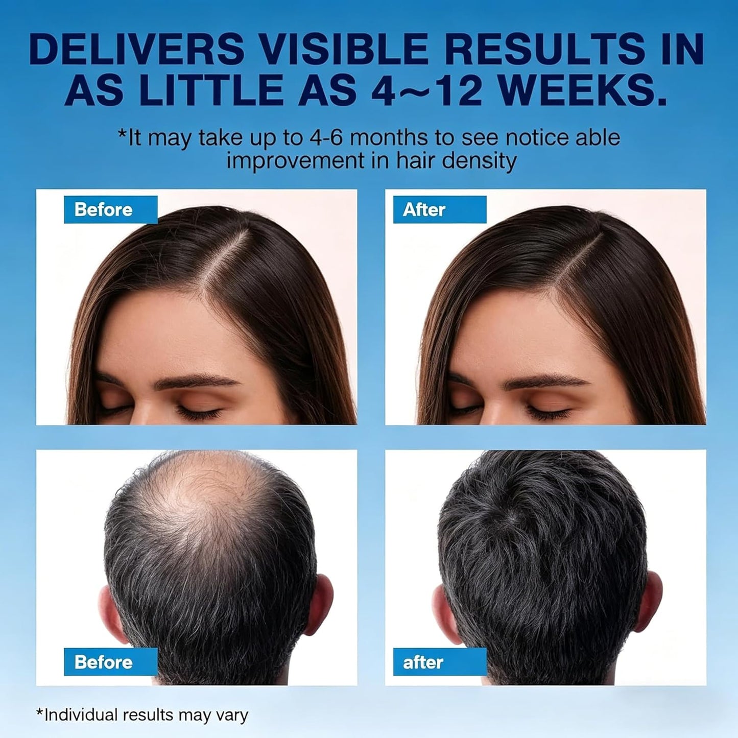 Minoxidil Foam for Men - Fast-Absorbing Hair Regrowth Treatment for Thinning Hair & Beard | 2 x 2.11 Oz (2 Month Supply)