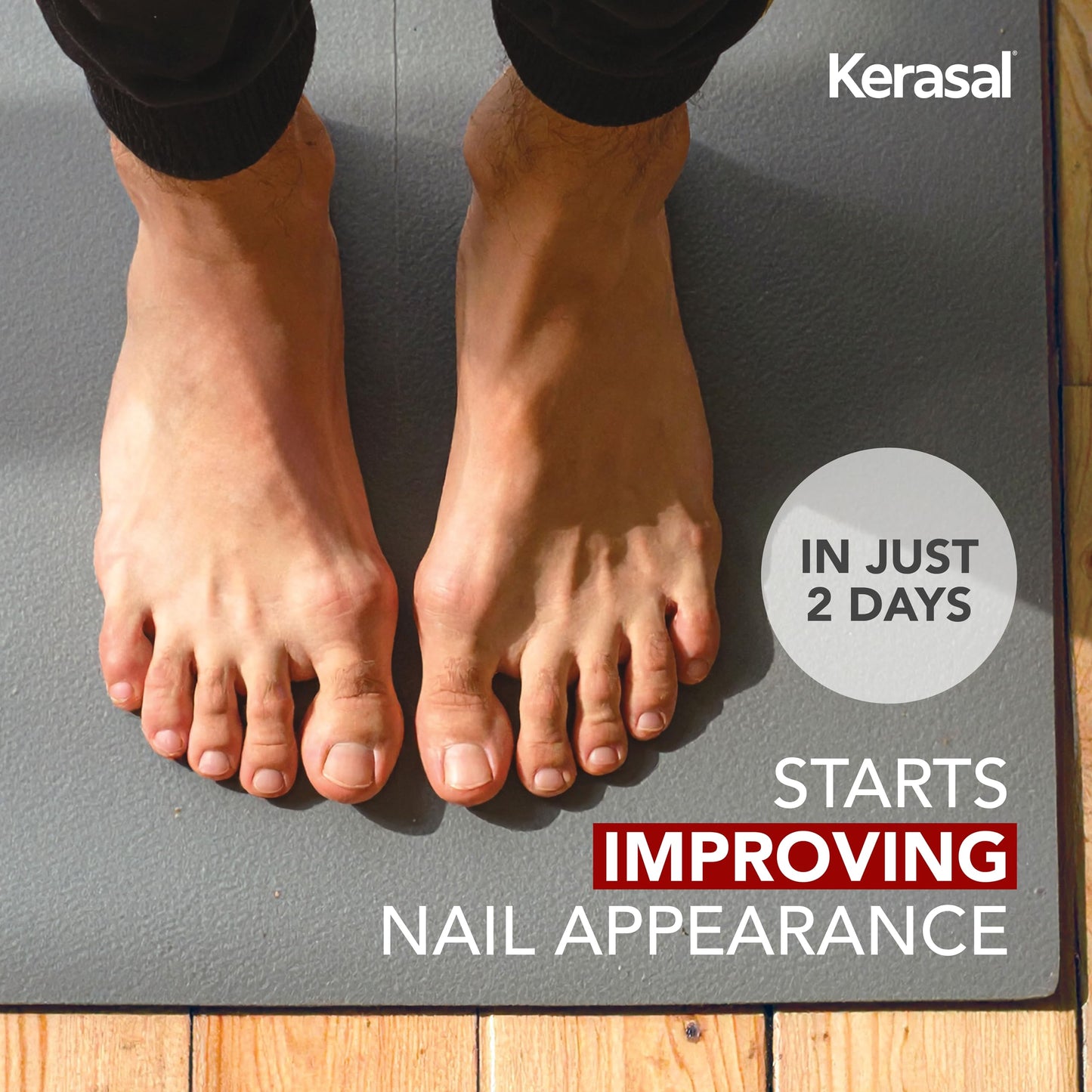 Kerasal Nail Renewal, Restorative Nail Repair for Damaged Nails, 0.33 fl oz (Packaging May Vary)