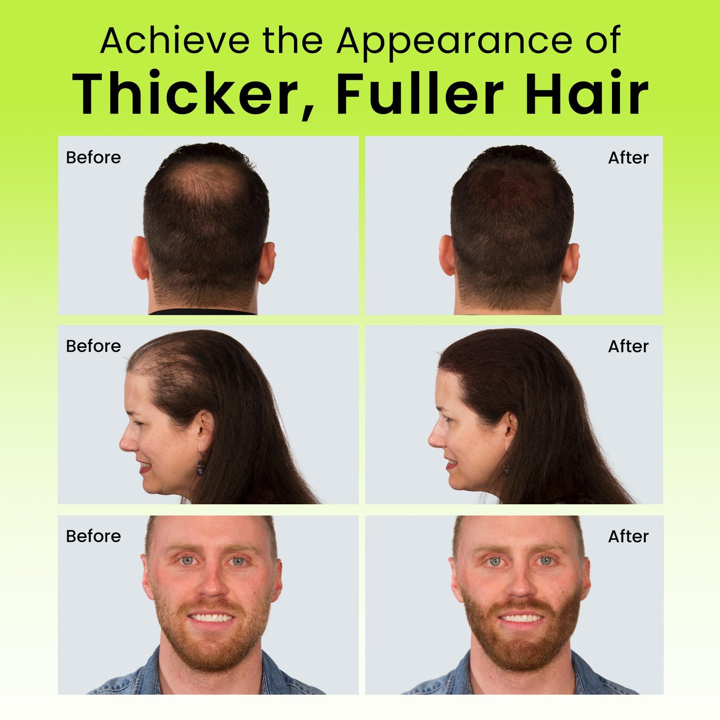 ECLIPSE Hair Fibers Medium Brown for Thinning Hair for Women & Men to Conceal Hair Loss in 15 Seconds - 100% Undetectable Hair Building Fibers, 15g