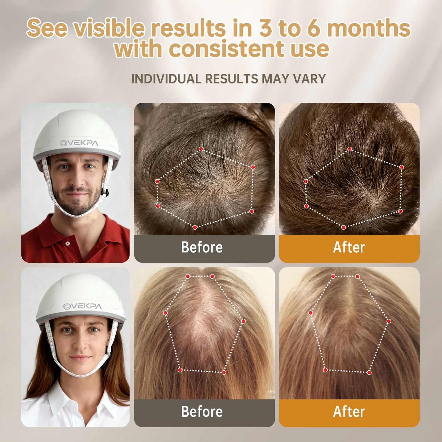 Red Light Therapy for Hair Growth - FDA Cleared Laser Cap for Hair Regrowth, Hair Loss Thinning & Alopecia Treatment for Men & Women, Wireless Rechargeable Model Hat-01 (White)