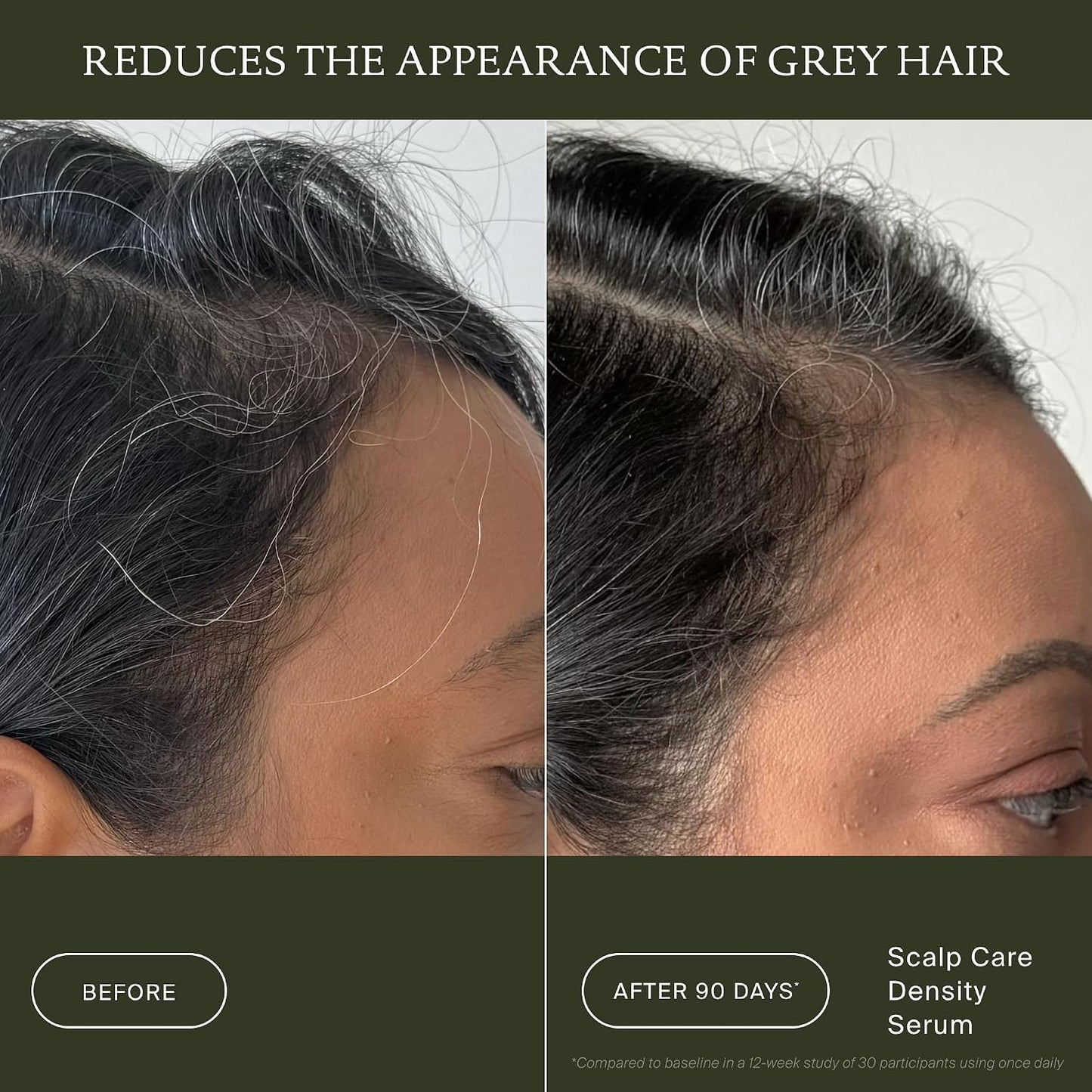 Living Proof Scalp Care Density Serum - Boost Hair Thickness & Volume 2 oz