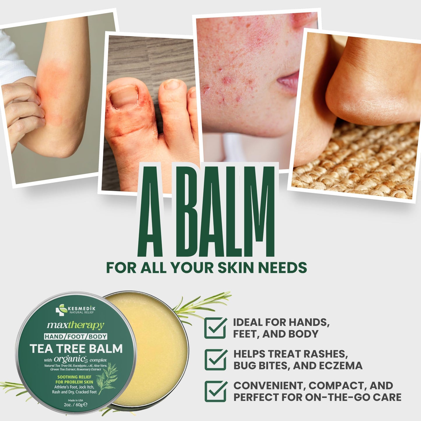 KESMEDIK Tea Tree Oil Balm for Skin, Soothes Itching, Rashes & Dry Skin, Antifungal Defense for Athlete’s Foot, Jock Itch, Chafing, Bug Bites & Eczema, Natural, Effective & Safe for All Ages, 2-Pack