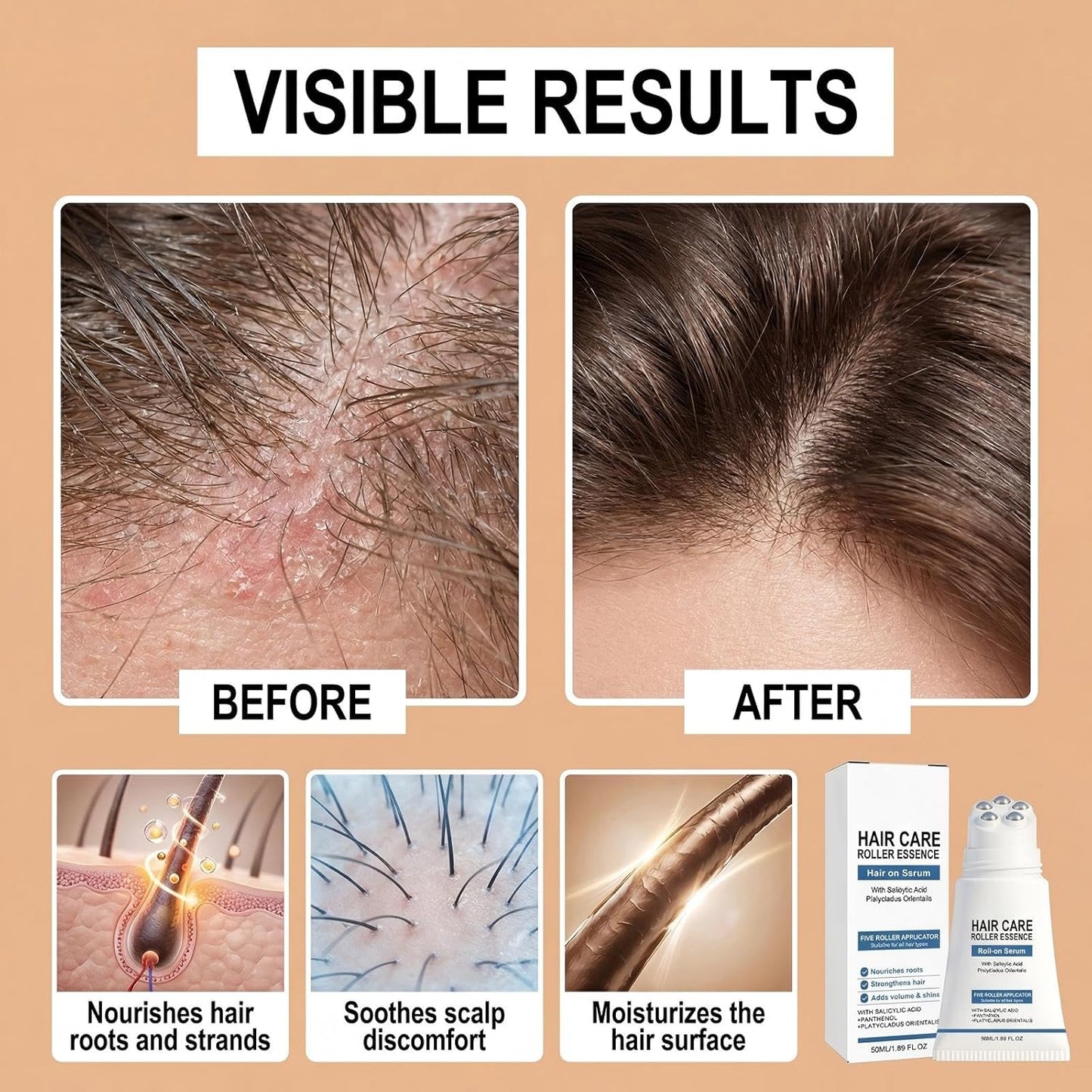 Hair Growth Serum Roll-On - Castor Oil & Salicylic Acid for Thicker, Healthier Hair | Scalp Care for Men & Women