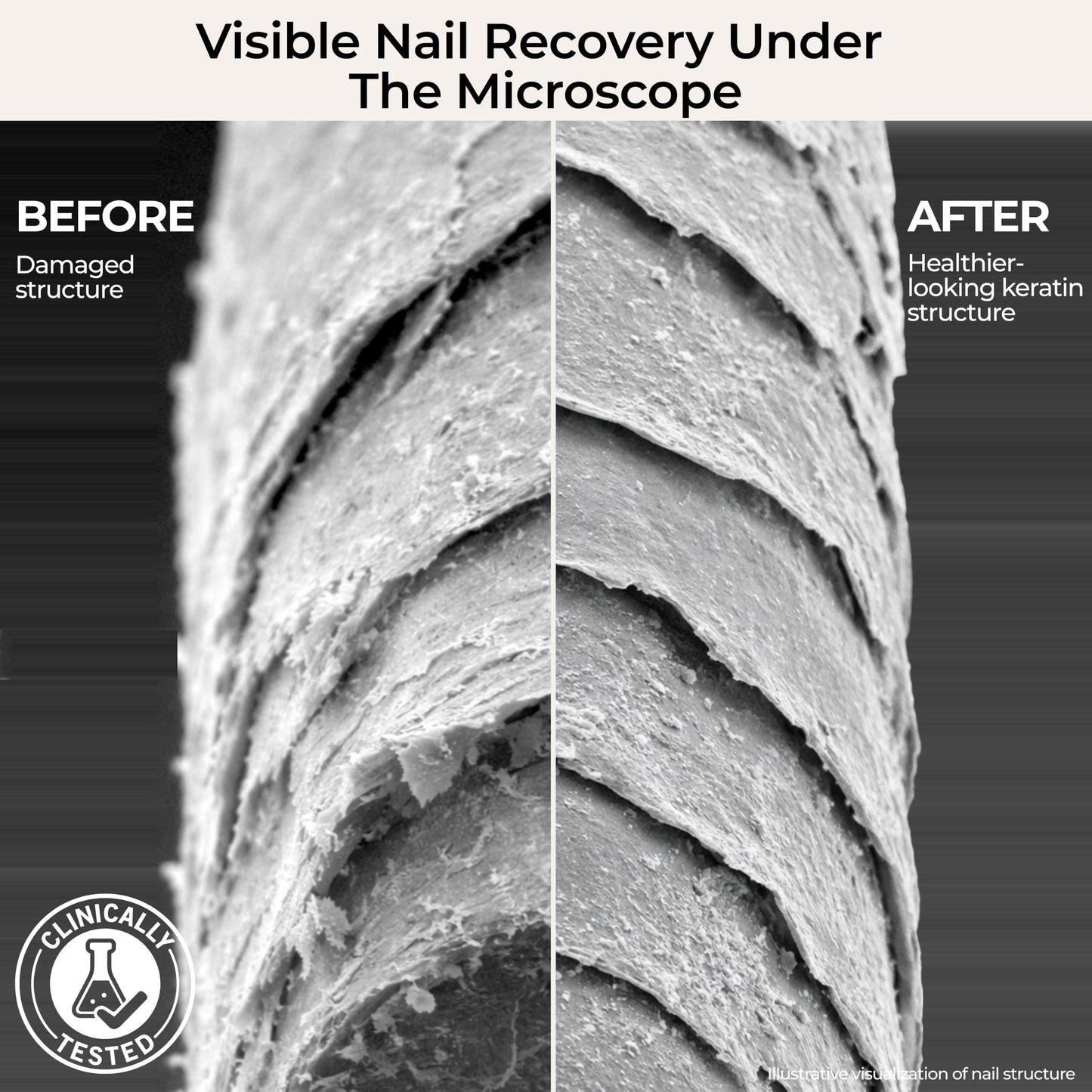nakeyNails Complete Nail Recovery Treatment for Gel & Acrylic Damage from Within for Stronger, Healthier Nails | With Keratin, Peptides, Niacinamide & Hyaluronic Acid — 45-Day Supply