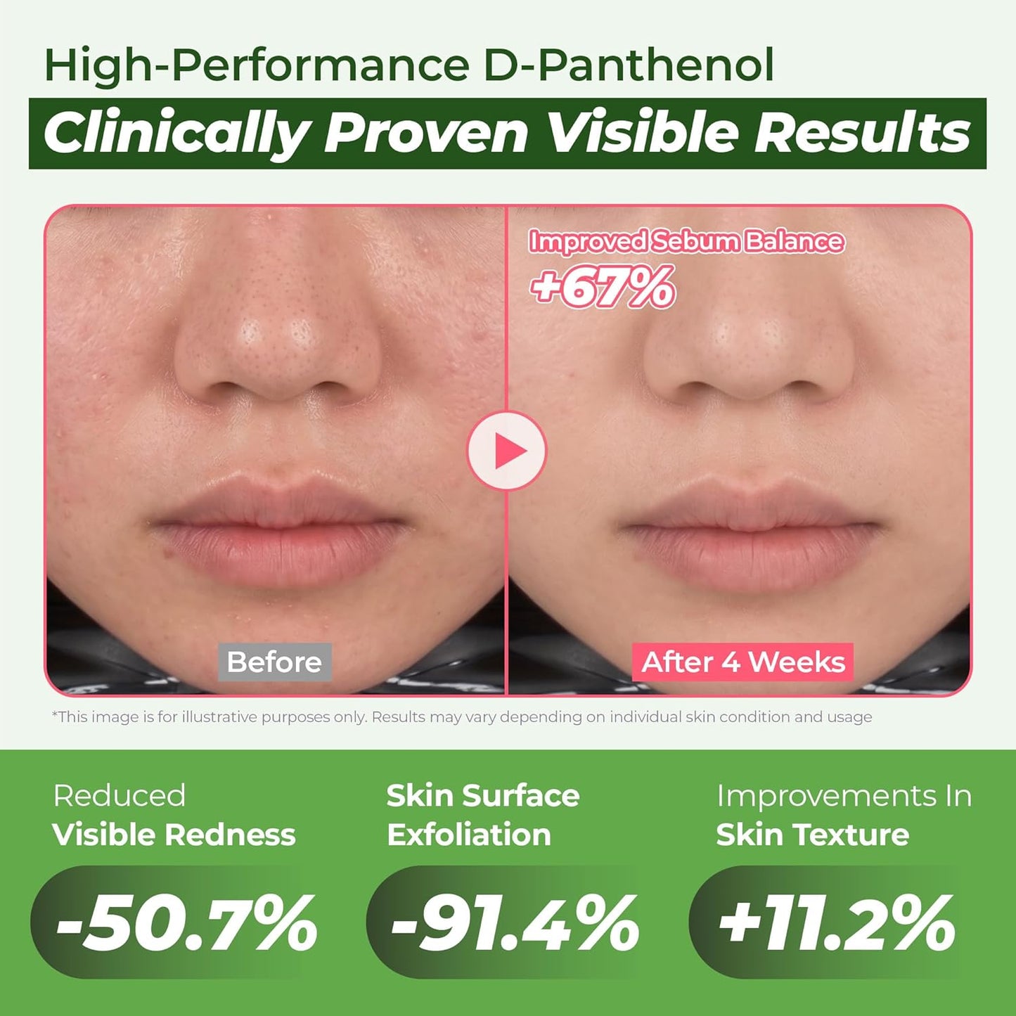 JUMISO D-Panthenol Hydrating Serum | 10 Types Hyaluronic Acid for Oily, Sensitive Skin - Jumbo 2.37 fl oz