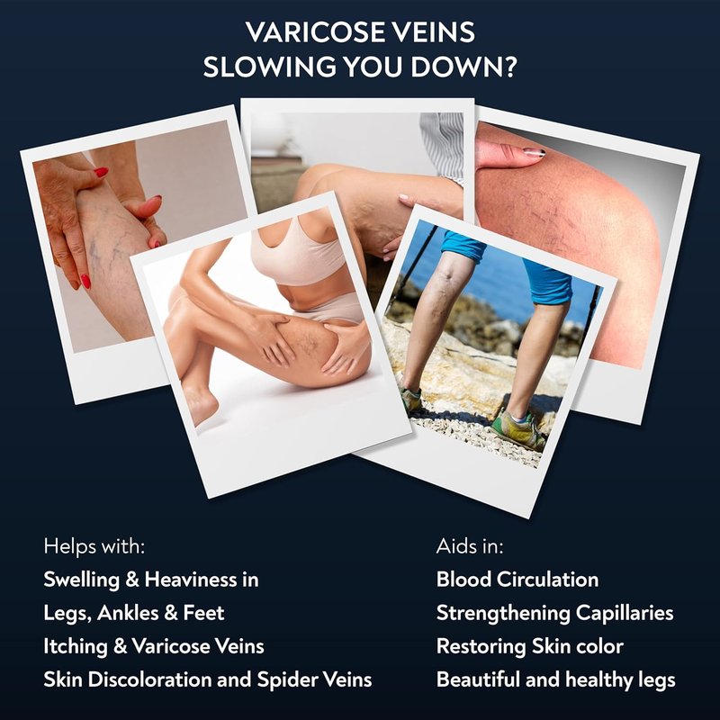 Varicose & Spider Vein Cream for Legs - Ayurvedic Ashwagandha Formula | Natural Non-Sticky Relief for Tired, Swollen Legs - 1 Pack