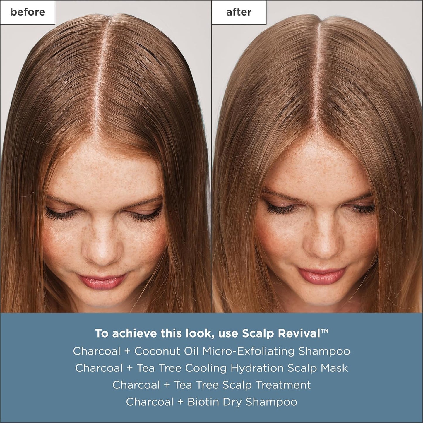 Briogeo Scalp Revival Charcoal & Tea Tree Treatment - Hydrating Leave-In Serum for Dry, Flaky Scalp | 1 oz