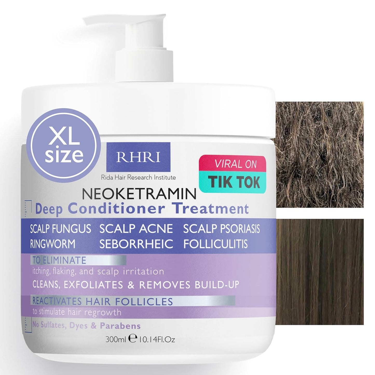 Anti Fungal Scalp Scrub for Men & Women - Medicated Dandruff Relief for Dry, Itchy, Flaky Scalp | Treat Folliculitis, Psoriasis, Ringworm