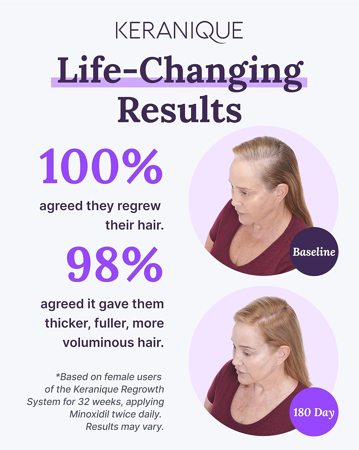Keranique Hair Regrowth Treatment for Women - 2% Minoxidil Topical Solution for Thinning Hair - 4 Fl Oz with Precision Spray Applicator