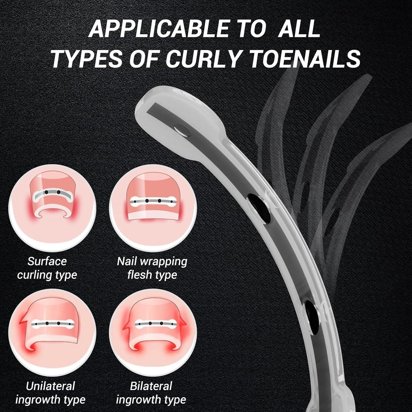 Ingrown Toenail Treatment Kit - Titanium Alloy Nail Tools for Curved Nail Repair | 0.59/0.67in