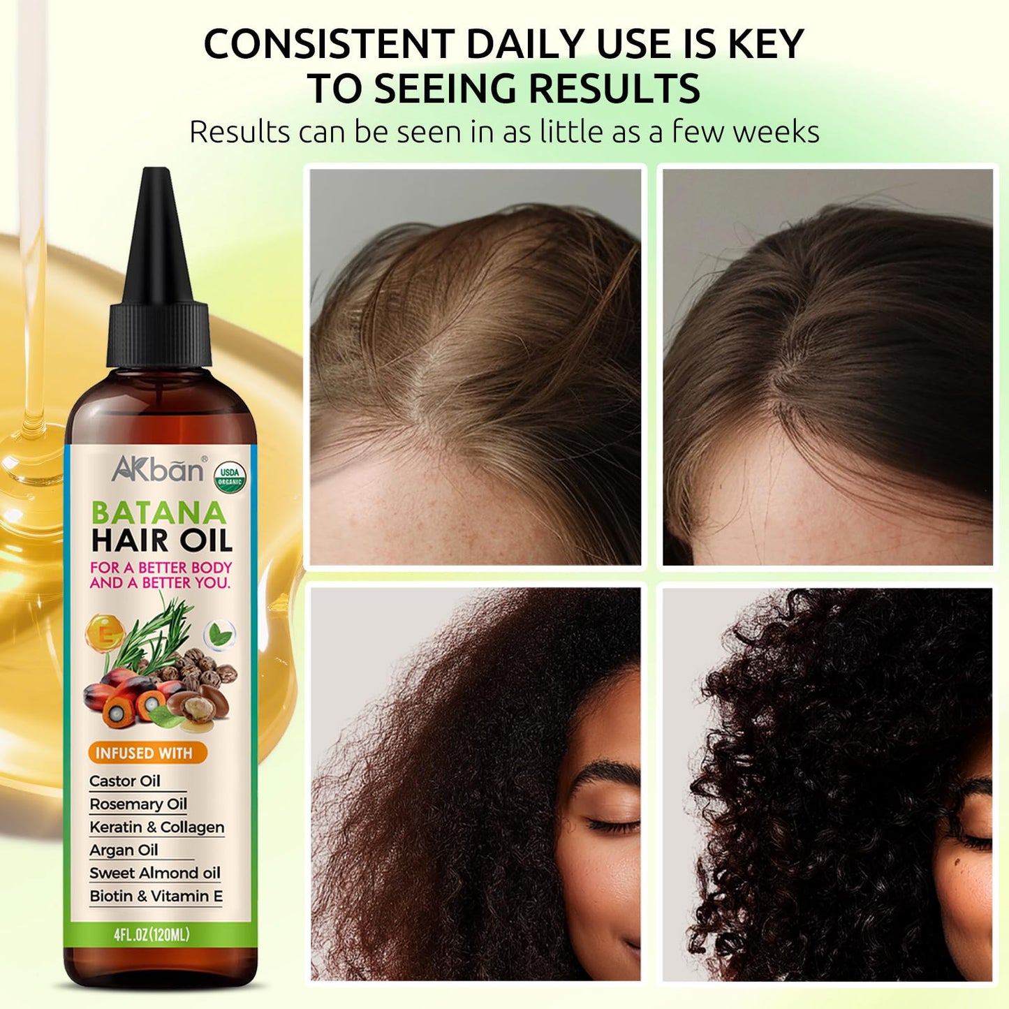AKBAN Hair Growth Oil with 100% Pure Batana, Castor, Rosemary & Pumpkin Seed Oils – Infused with Biotin, Keratin & Vitamin E – Strengthening & Thickening Treatment for Healthy Hair – 4 FL OZ