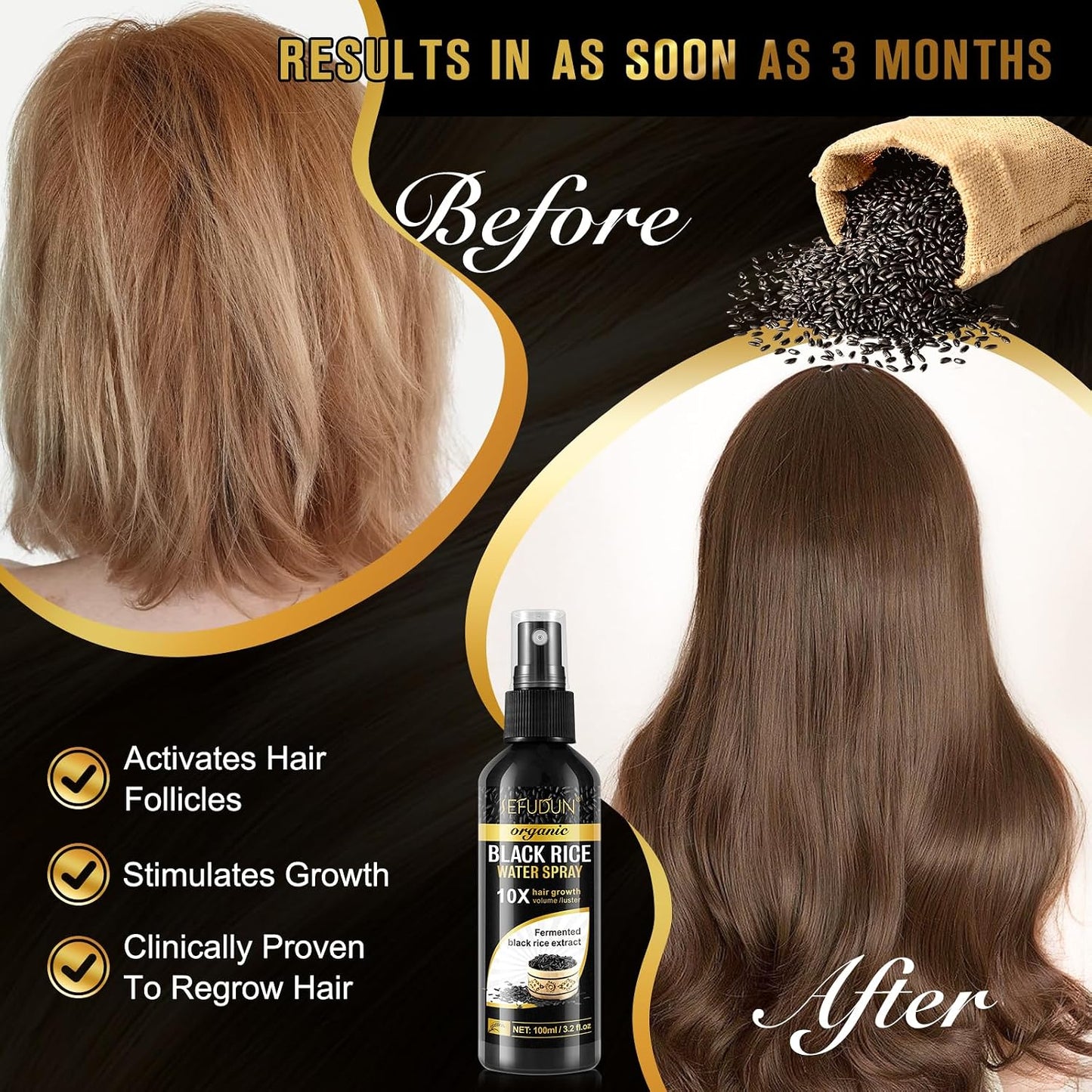Organic Black Rice Water Spray - Hair Growth Solution with Castor Oil & Ginger Extract | 100ml/3.2 fl.oz
