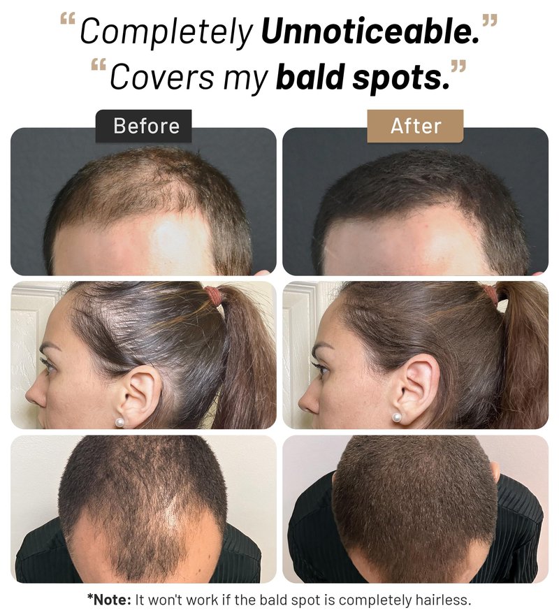 CONFIERR Hair Fibers for Men & Women (30 Grams, Black), Fill In Fine or Thinning Hair, Instantly Thicker, Fuller Looking Hair