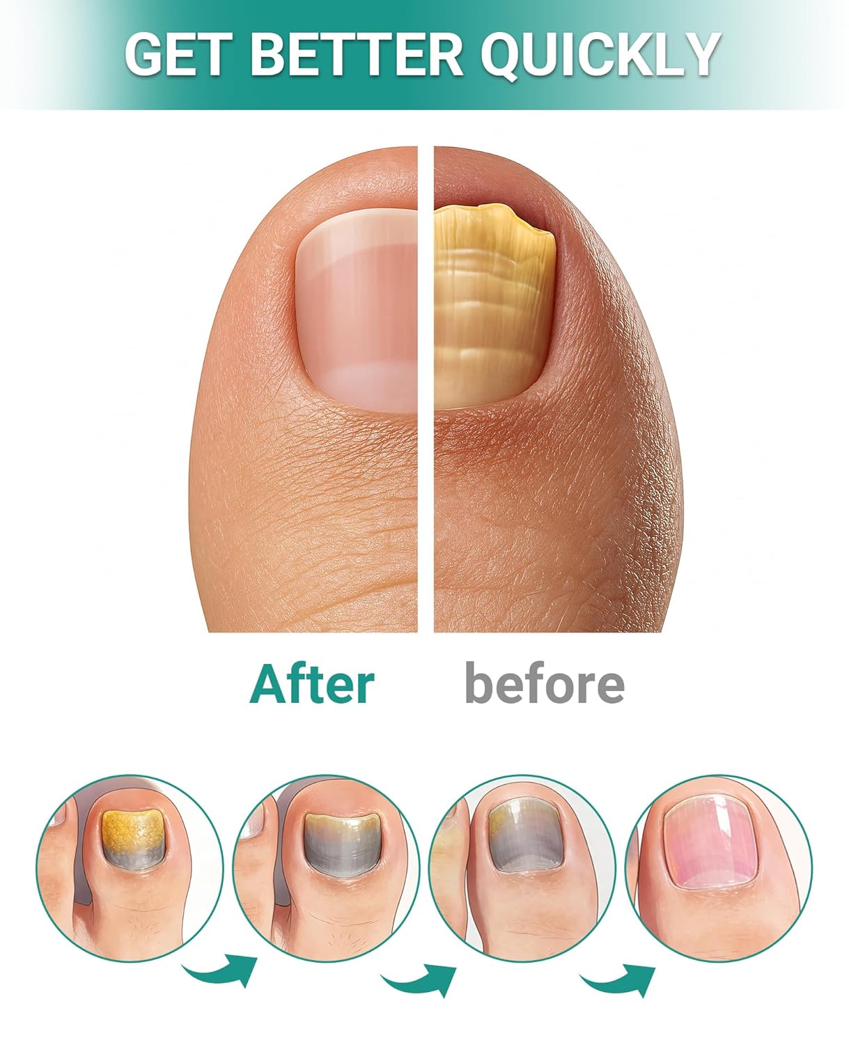 32 Pcs Hydrogel Toenail Treatment Patches - Extra Strength for Ingrown Toenail Care | Overnight Repair