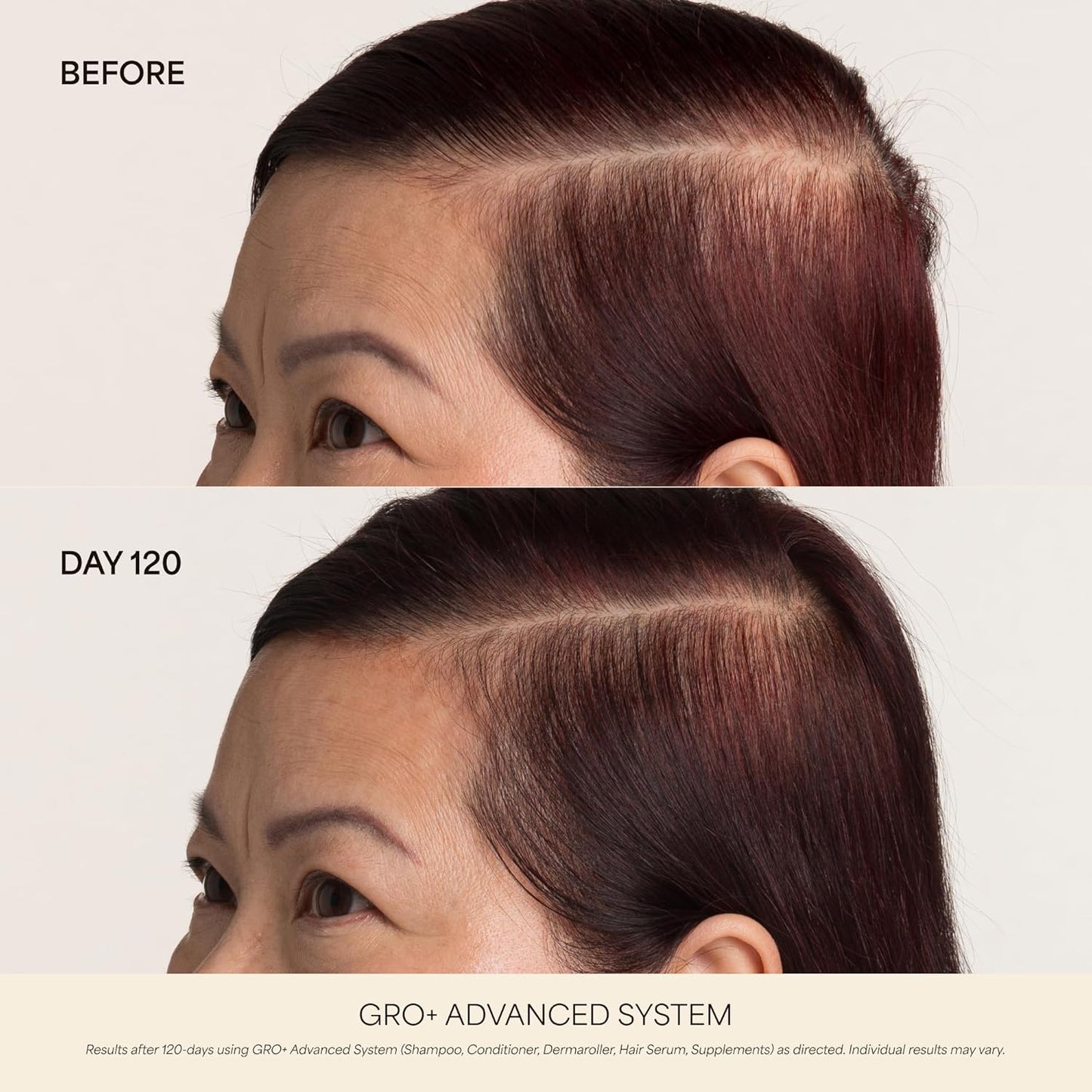 VEGAMOUR GRO+ Hair Growth Supplements - Advanced Density Formula for Thicker Hair