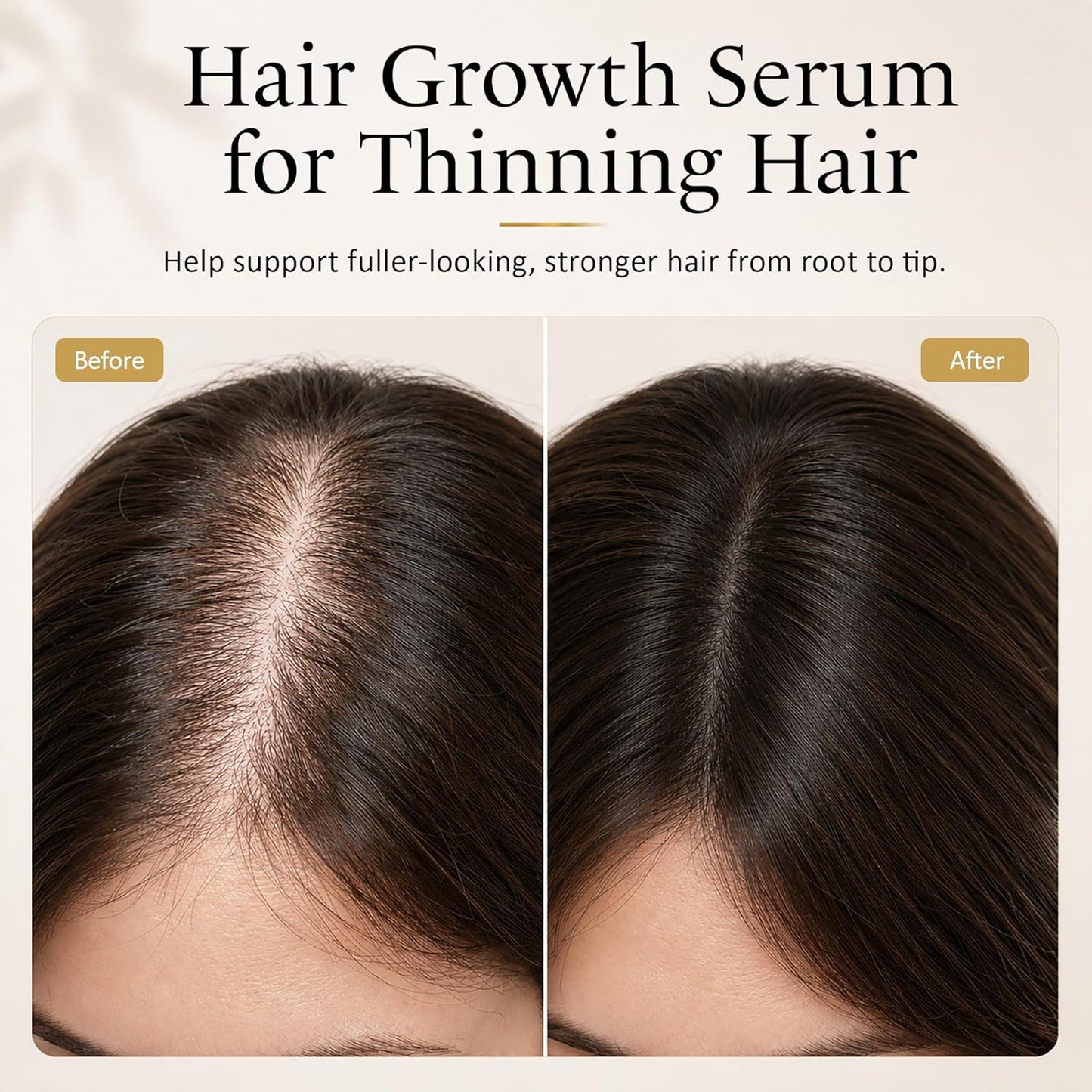 Advanced Hair Growth Serum - Aloe Vera & Biotin Oil for Thicker, Fuller Hair | 60ml