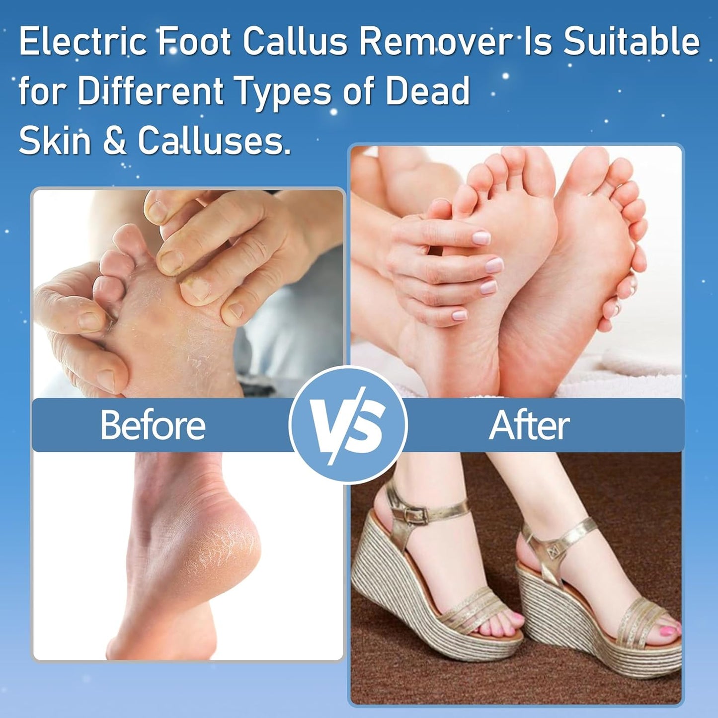 Electric Foot Callus Remover - Waterproof Rechargeable Pedicure Kit with 3 Rollers & 2 Speed Settings | Ideal for Hard, Cracked Skin