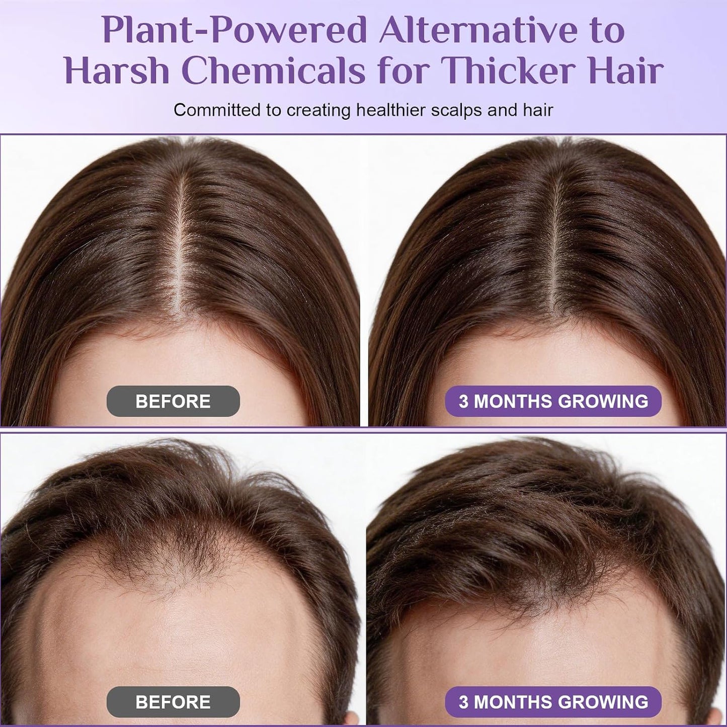 Rosemary Hair Growth Serum Roll-On - Biotin & Caffeine for Thicker Hair | 1 Fl Oz (Pack of 2)