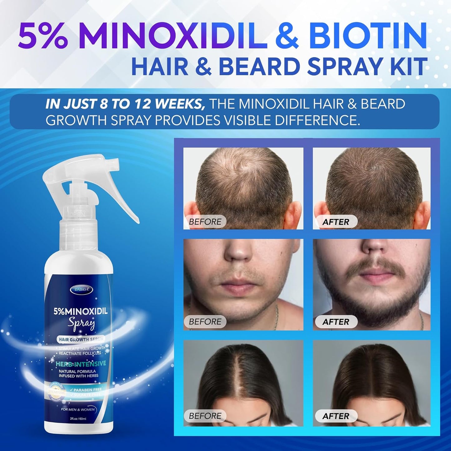 Minoxidil Hair Regrowth Spray - 5% Treatment for Women & Men | 60ml Beard & Hair Growth Solution