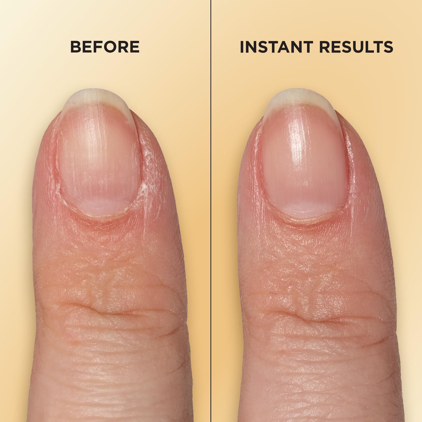 Sally Hansen Vitamin E Nail & Cuticle Treatment Pen | Hydrates and Conditions Dry Nails | Nourishing Formula with Apricot Oil | Smooth, Healthy-Looking Nails | Easy, Mess-Free Nail Care on the Go