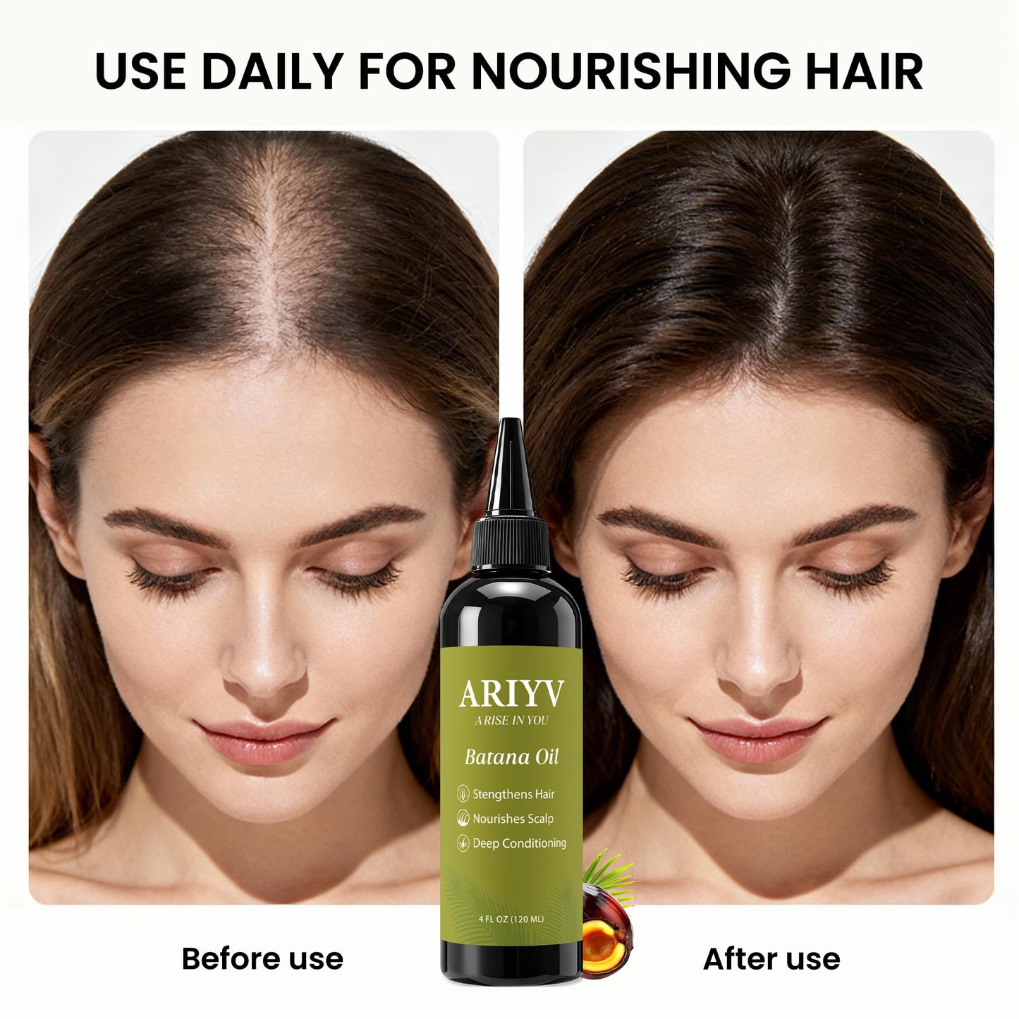 Ariyv Batana Oil for Hair Growth, Natural Batana Oil - Prevents Hair Loss, Reduces Breakage and Strengthens Hair, Enhances Thickness for Men & Women