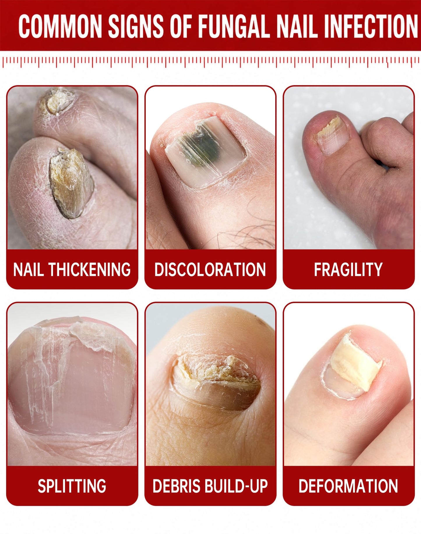 Toenail Fungus Treatment Extra Strength - 1% Tolnaftate & Triple Acid Complex - Repairs Thick, Yellow, Discolored & Damaged Nails - Fast-Acting Fungal Nail Treatment - 0.51 fl oz