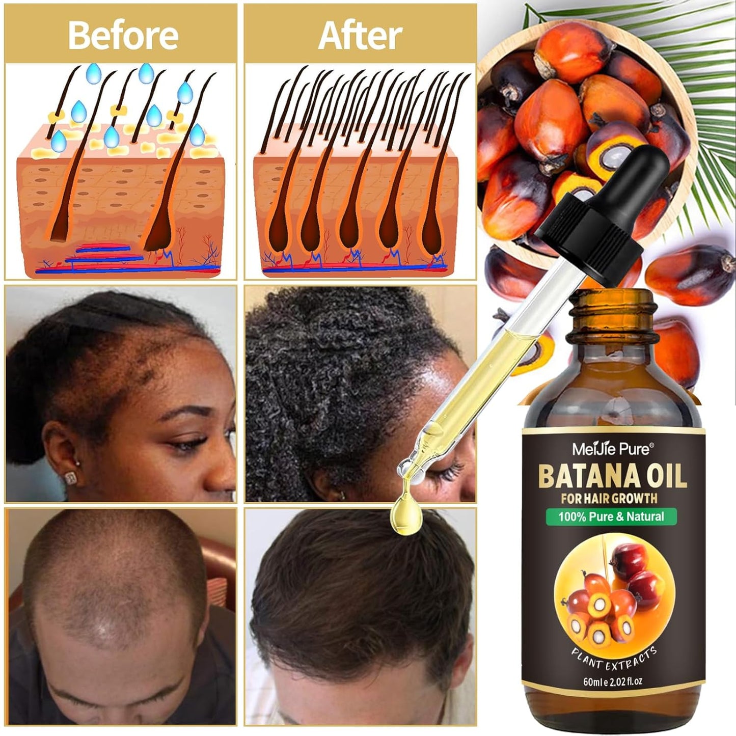 Batana Oil for Hair Growth - 4Pc Set with Hair Mask, Lash Wand & Brow Brush | Promotes Thickness & Prevents Hair Loss
