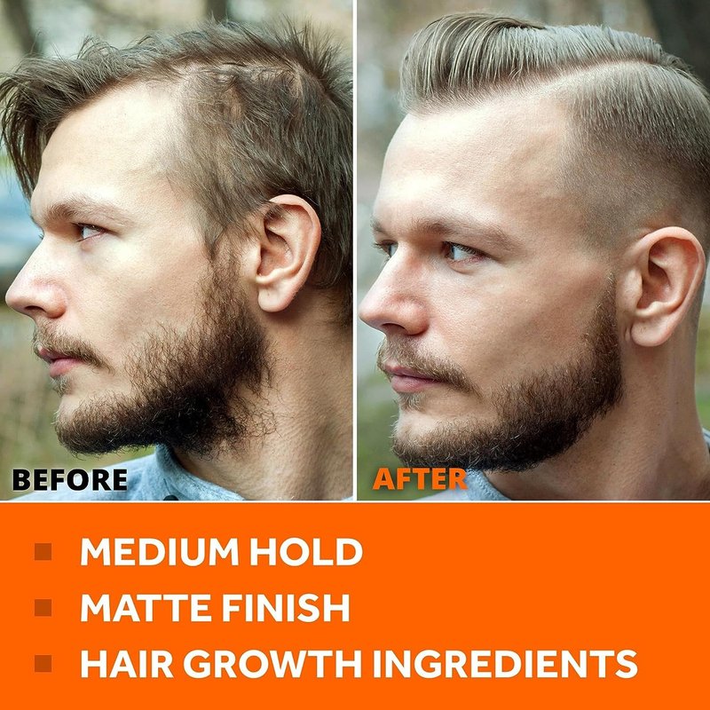 FOLLICLE BOOSTER Thickening Styling Pomade - 2 Pack Medium Hold, Water Base, Matte Finish - Natural Hair Growth Paste for Men with Hair Loss Combating Ingredients