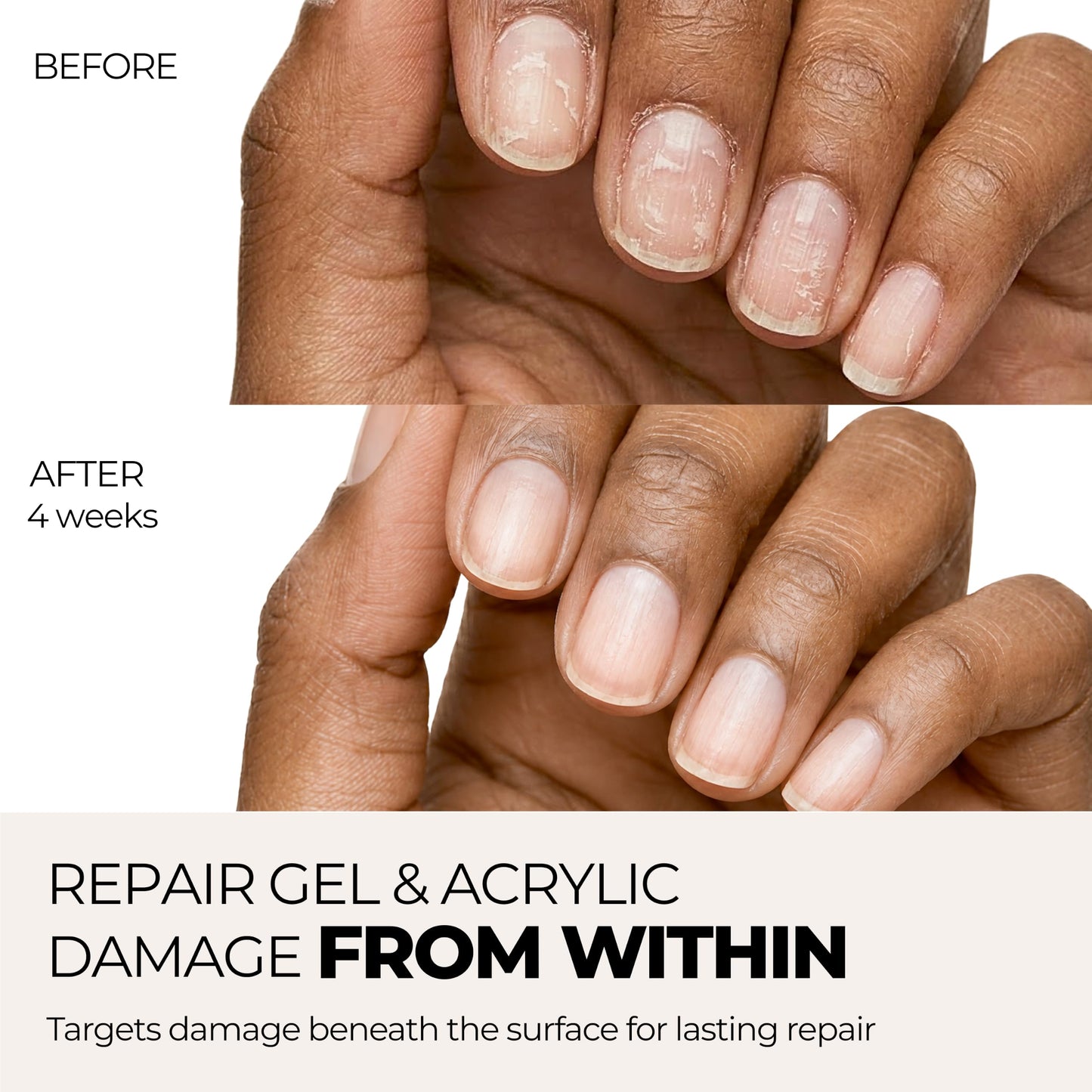 nakeyNails Complete Nail Recovery Treatment for Gel & Acrylic Damage from Within for Stronger, Healthier Nails | With Keratin, Peptides, Niacinamide & Hyaluronic Acid — 45-Day Supply