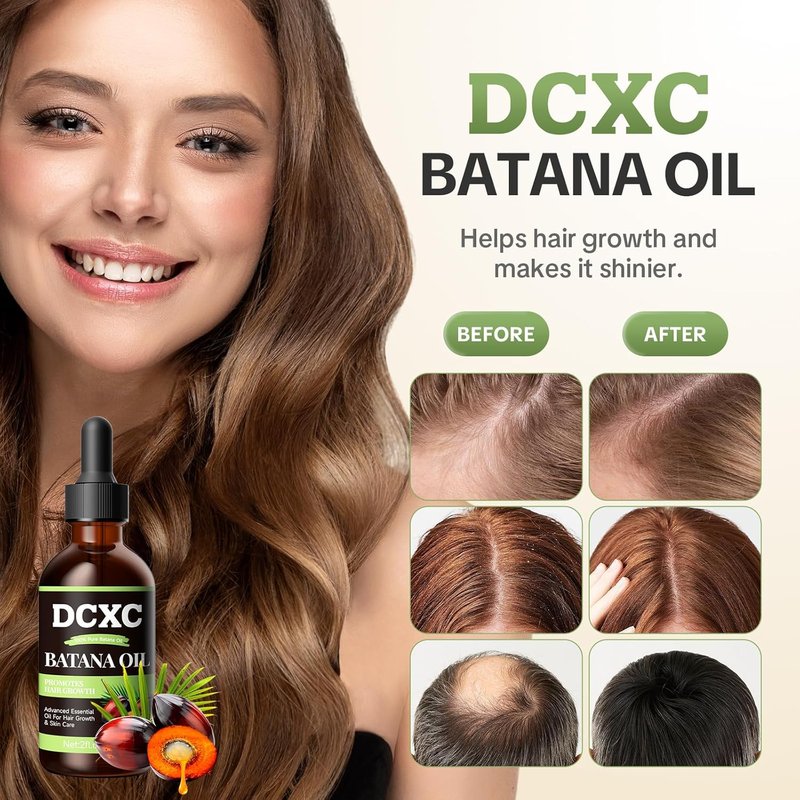 Batana Oil for Hair Growth - Natural Scalp Care & Thickening Treatment | Revitalizes Damaged Hair, Reduces Breakage | 2oz