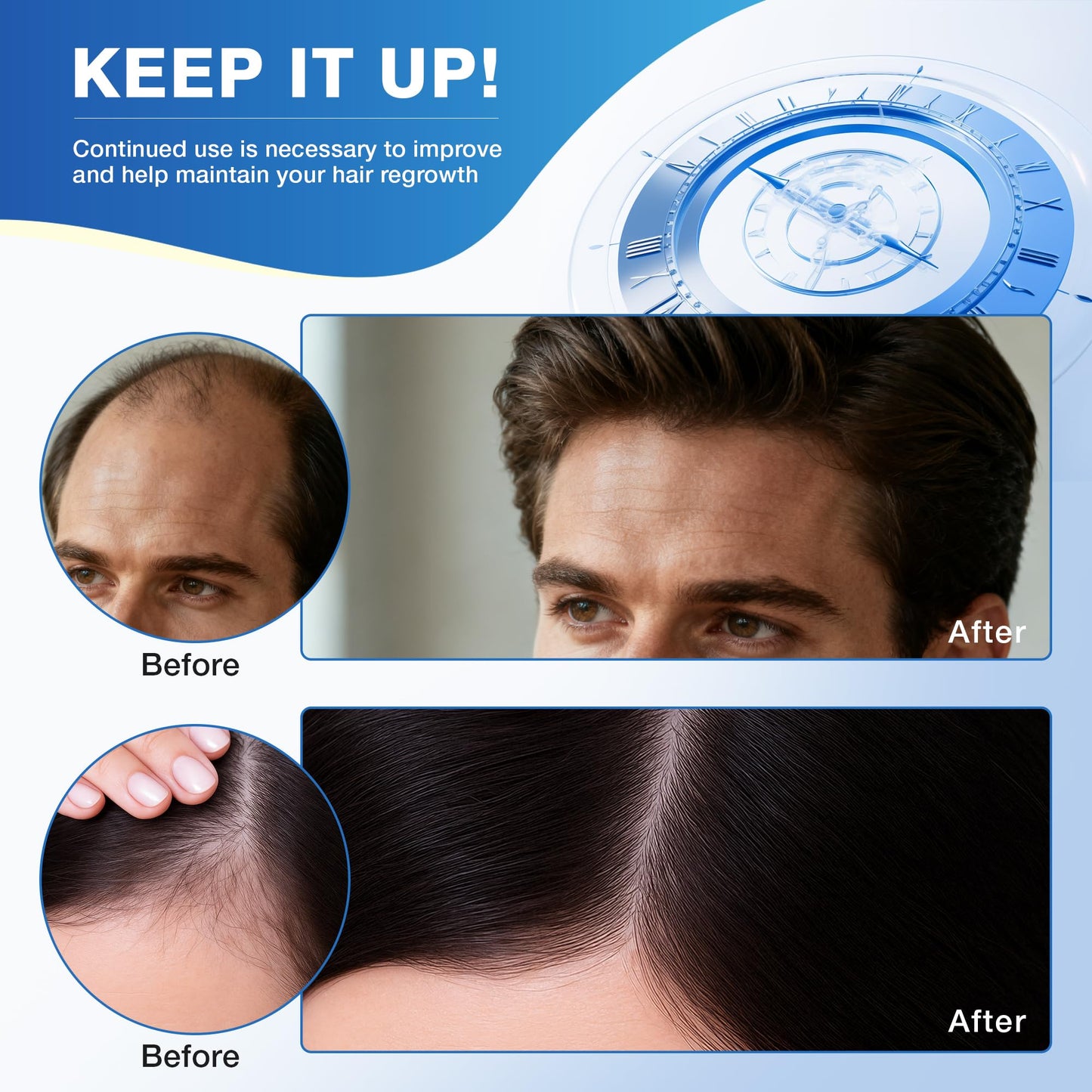 HairVibe 5% Minoxidil Foam, Hair Regrowth Treatment for Men & Women, 2-Pack