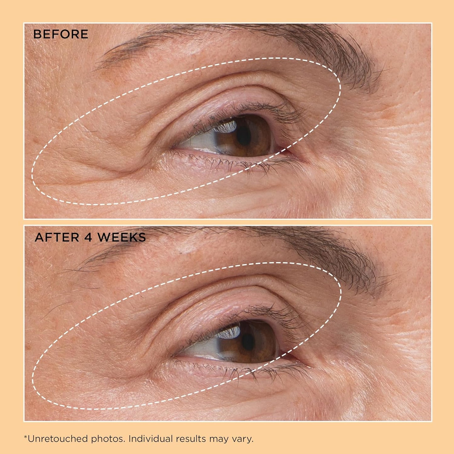 Perricone MD Neuropeptide Eyelid Lift Serum - Anti-Aging Formula, 0.5 fl oz