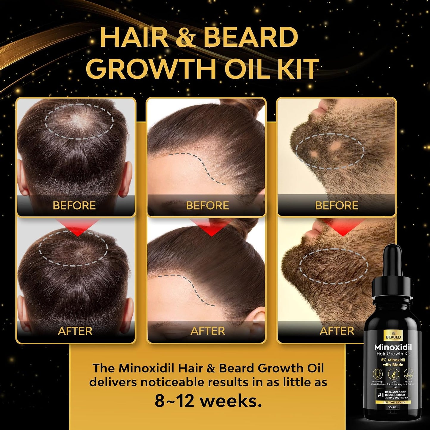 Minoxidil Beard Growth Kit for Men & Women - Hair Regrowth Treatment 5% | Black
