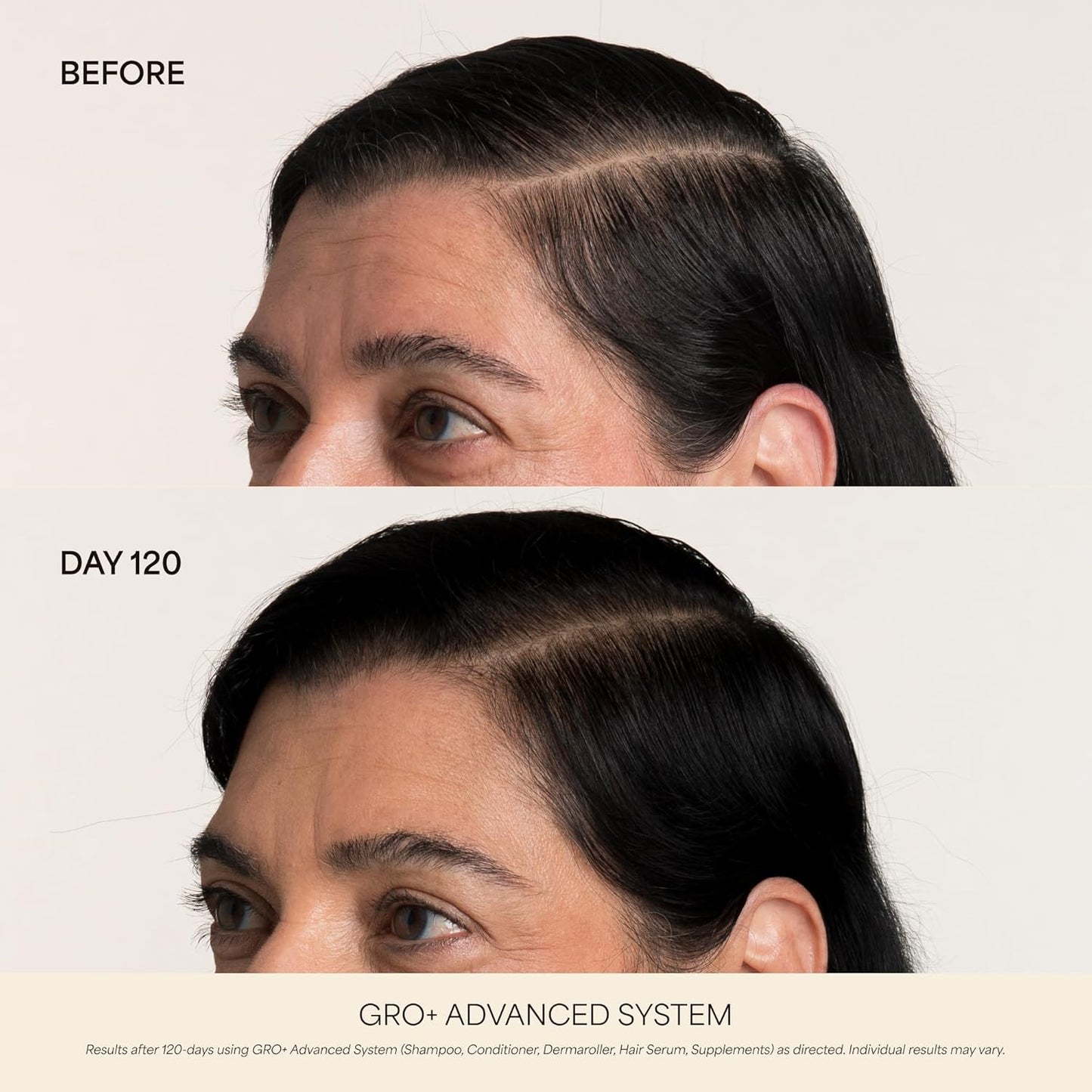 VEGAMOUR GRO+ Advanced Hair Density Gel-Serum | Cooling Massage Pen for Thinning Hair, Vegan & Cruelty-Free
