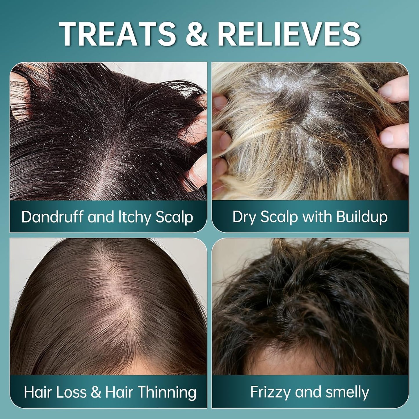 Sea Salt Scalp Scrub & Exfoliating Shampoo - Soothes Itchy, Oily Scalp with Rosemary, Coconut & Shea Butter | 8 oz