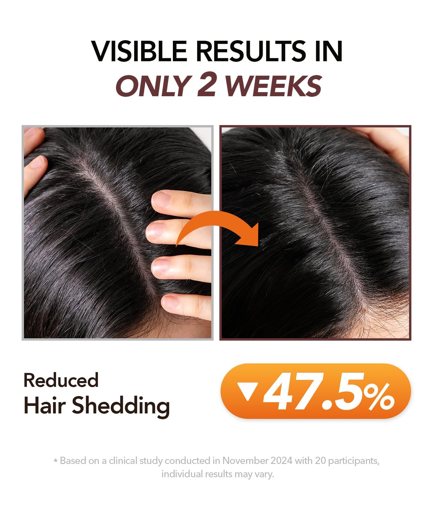 Motifull Hair Boosting Treatment | Biotin, Caffeine & TrinogeniX Formula for Fine Hair | Visibly Fuller-Looking Hair & Nourishing Scalp Treatment (6.76 fl oz)