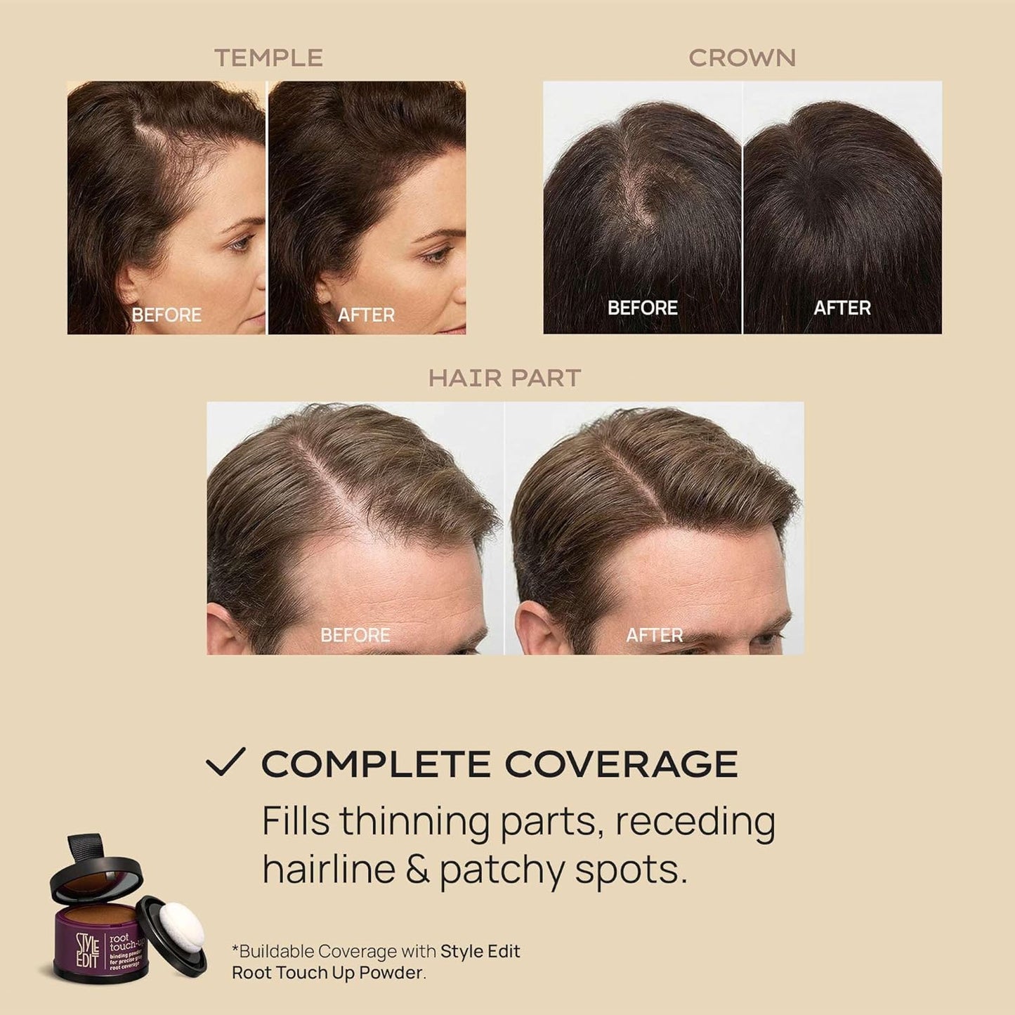 Hair Building Fibers for Thinning Hair - Plant-Based Concealer for Receding Hairlines & Bald Spots | Black 0.88oz